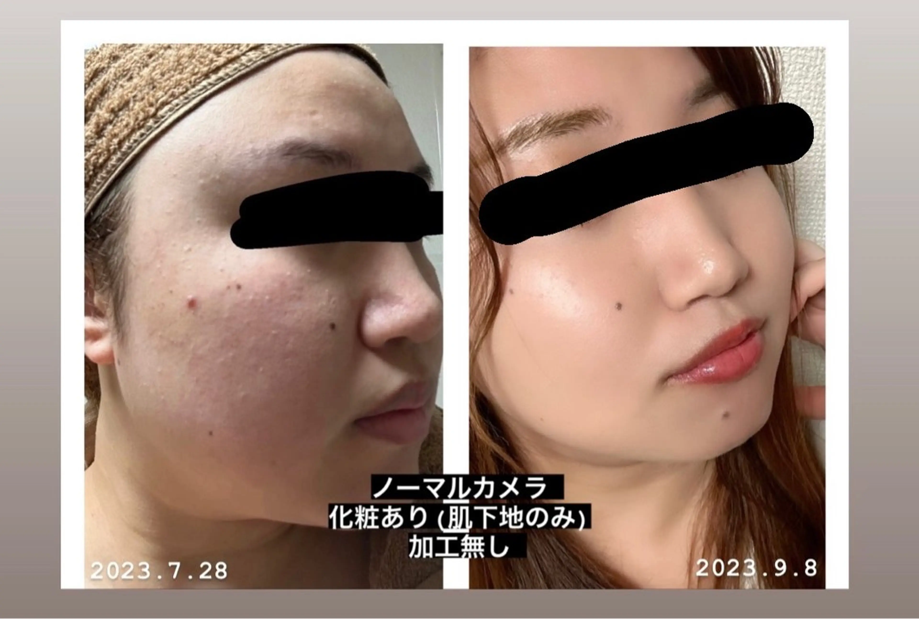 エステ リラク エステティックサロン YouMeのエステ・リラクイメージ