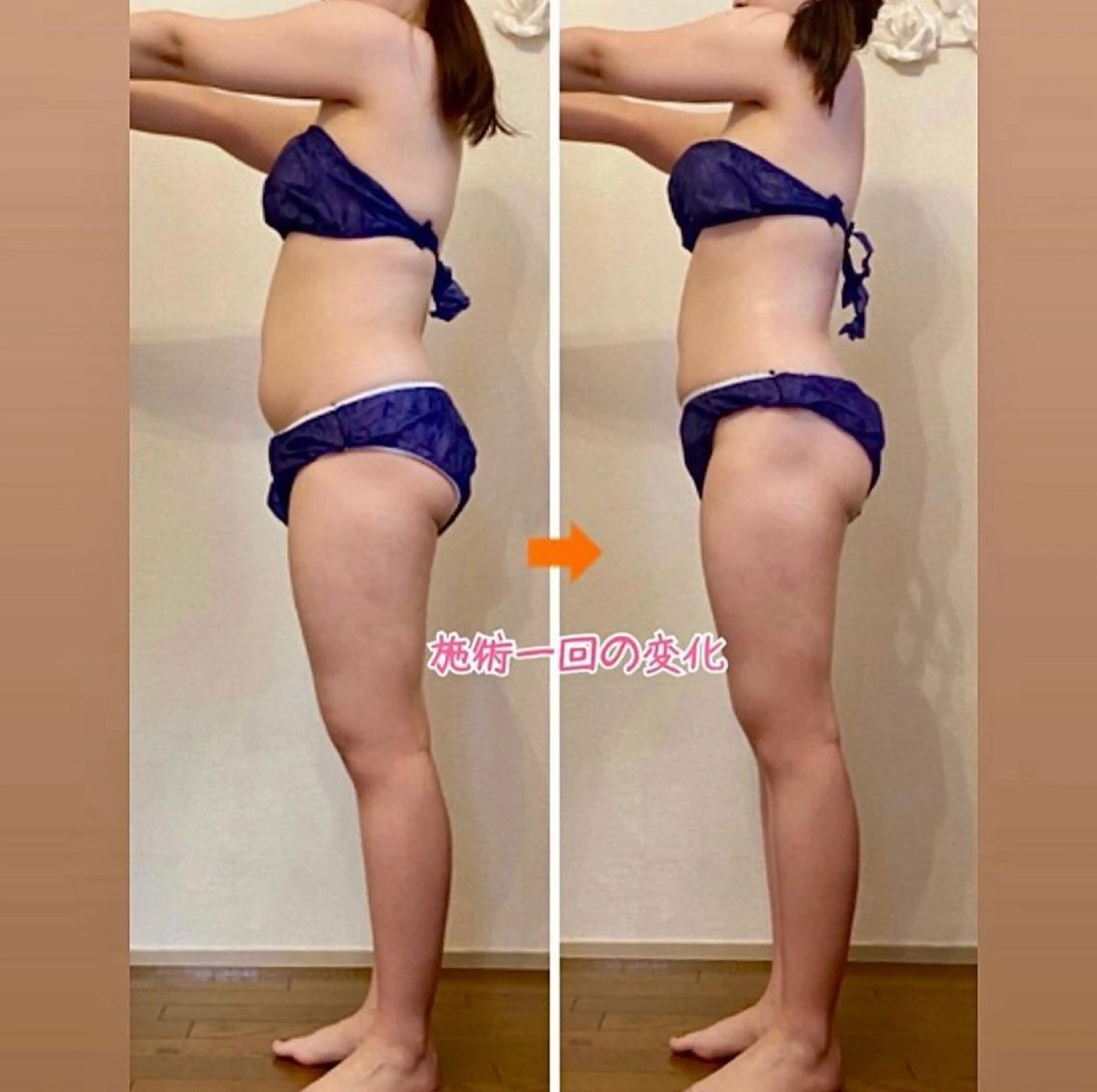 ショート カラー パーマ ヘアアレンジ メンズ キッズ ネイル マツエク・マツパ マットネイル 赤色 エステ リラク ‍痩身＆ボディ 結果出し🌟丹野のエステ・リラクイメージ