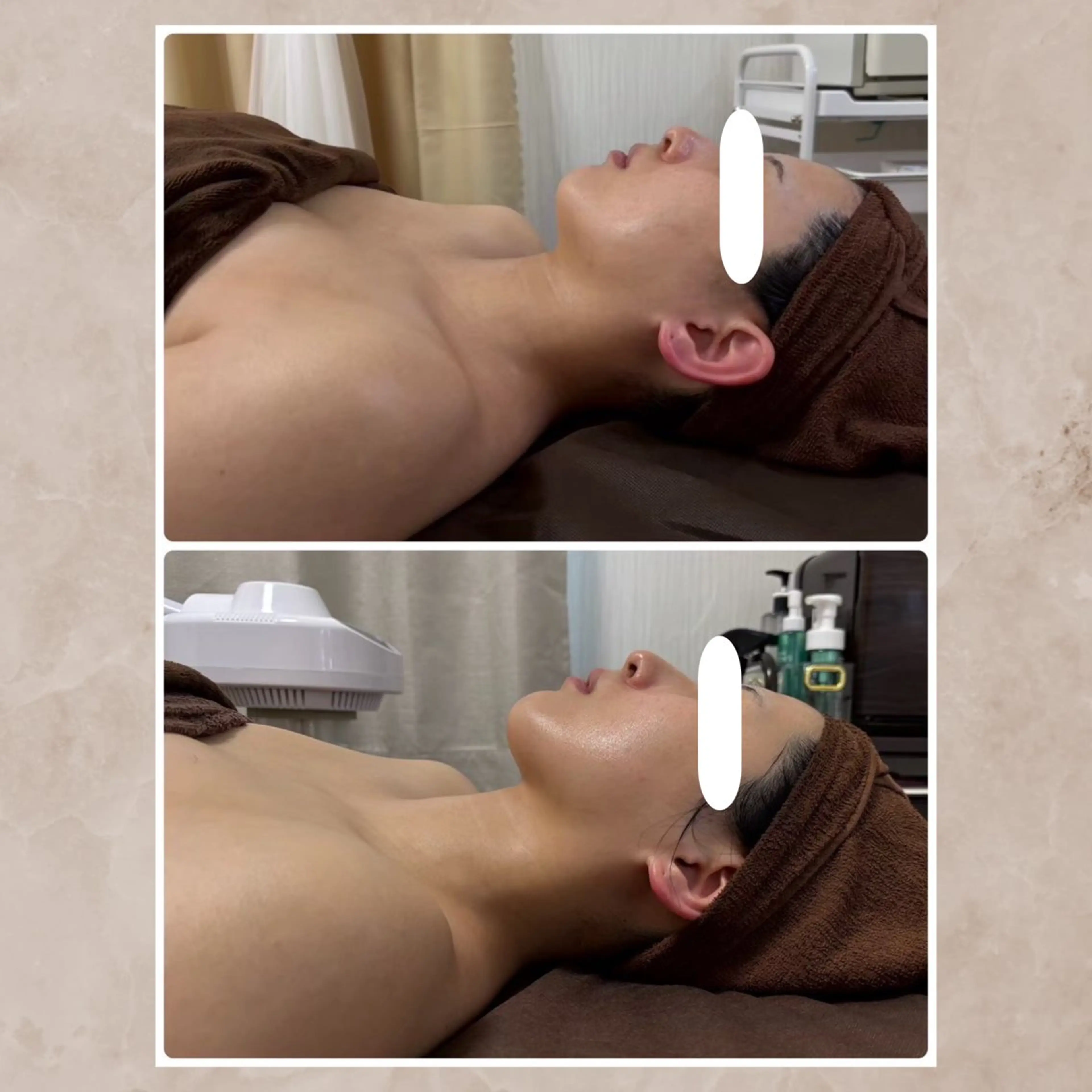 Total Beauty Salon Vi's CLUB by BINEL所属・Vi's CLUB KOTONOのエステ・リラクイメージ