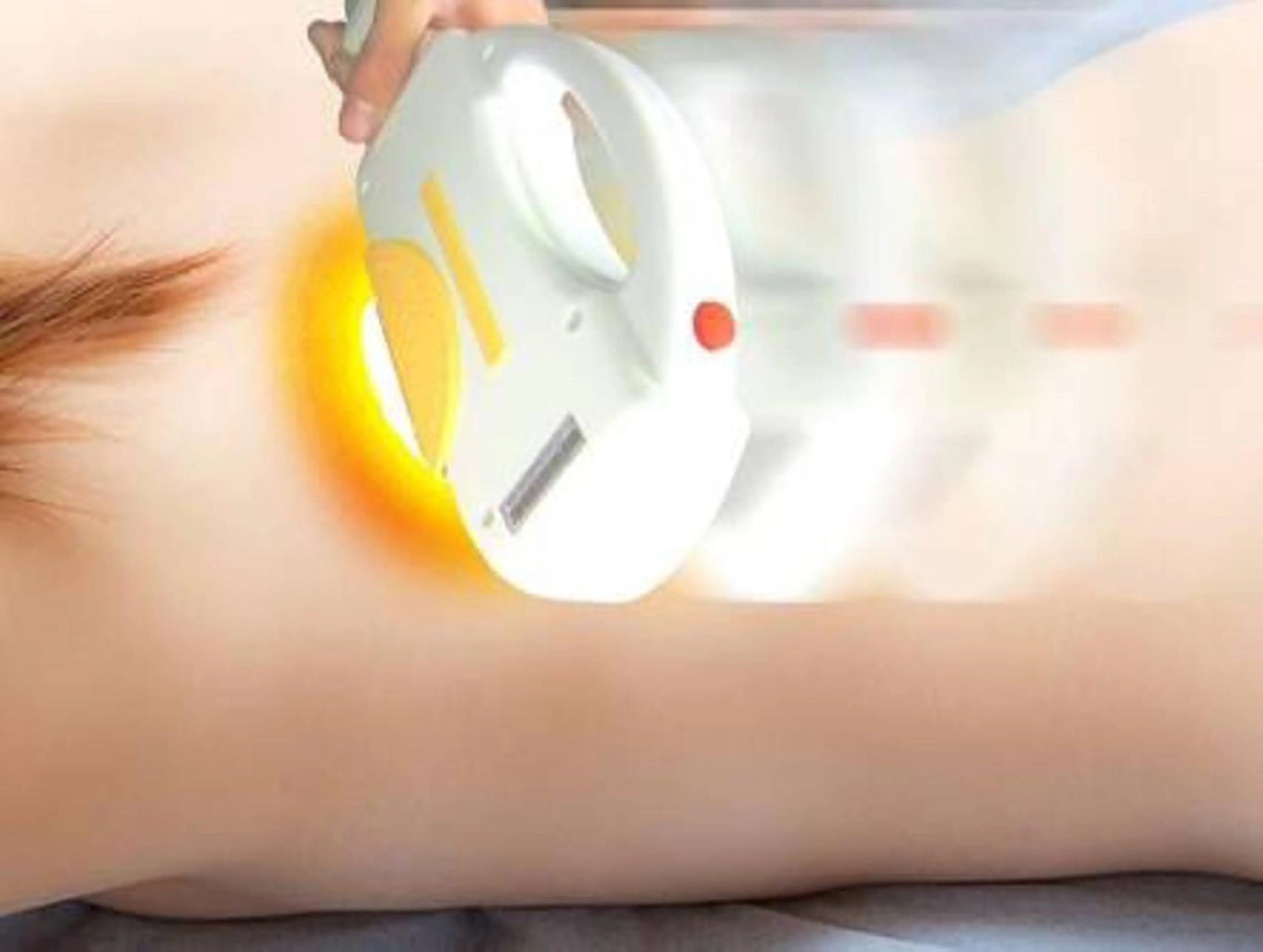 人気NO.1👑【脱毛】デリケートゾーンV.I.O脱毛１回3300円の写真