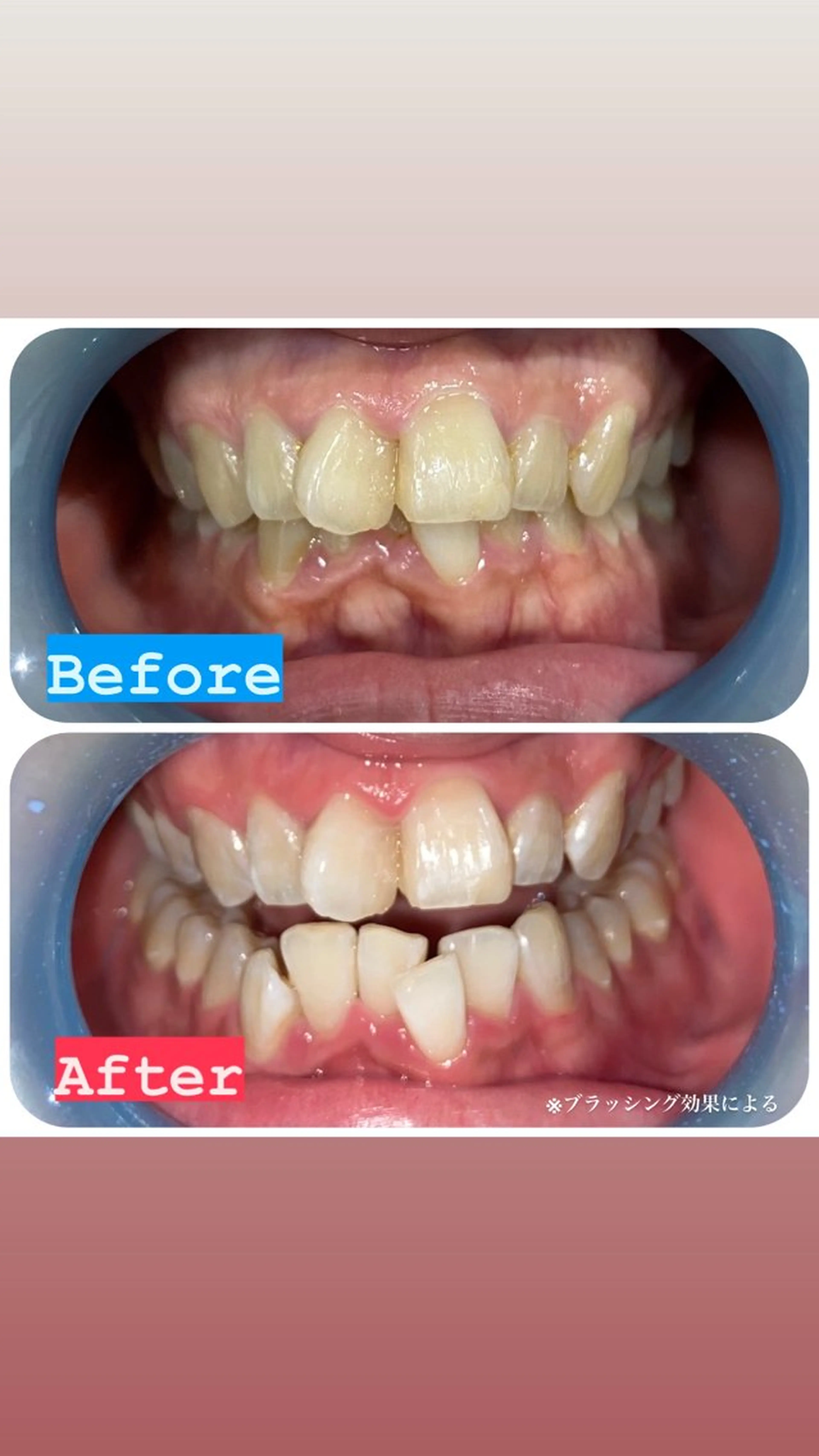 その他 SOLUNA(ソルーナ)所属・SOLUNA 💛staffのエステ・リラクイメージ