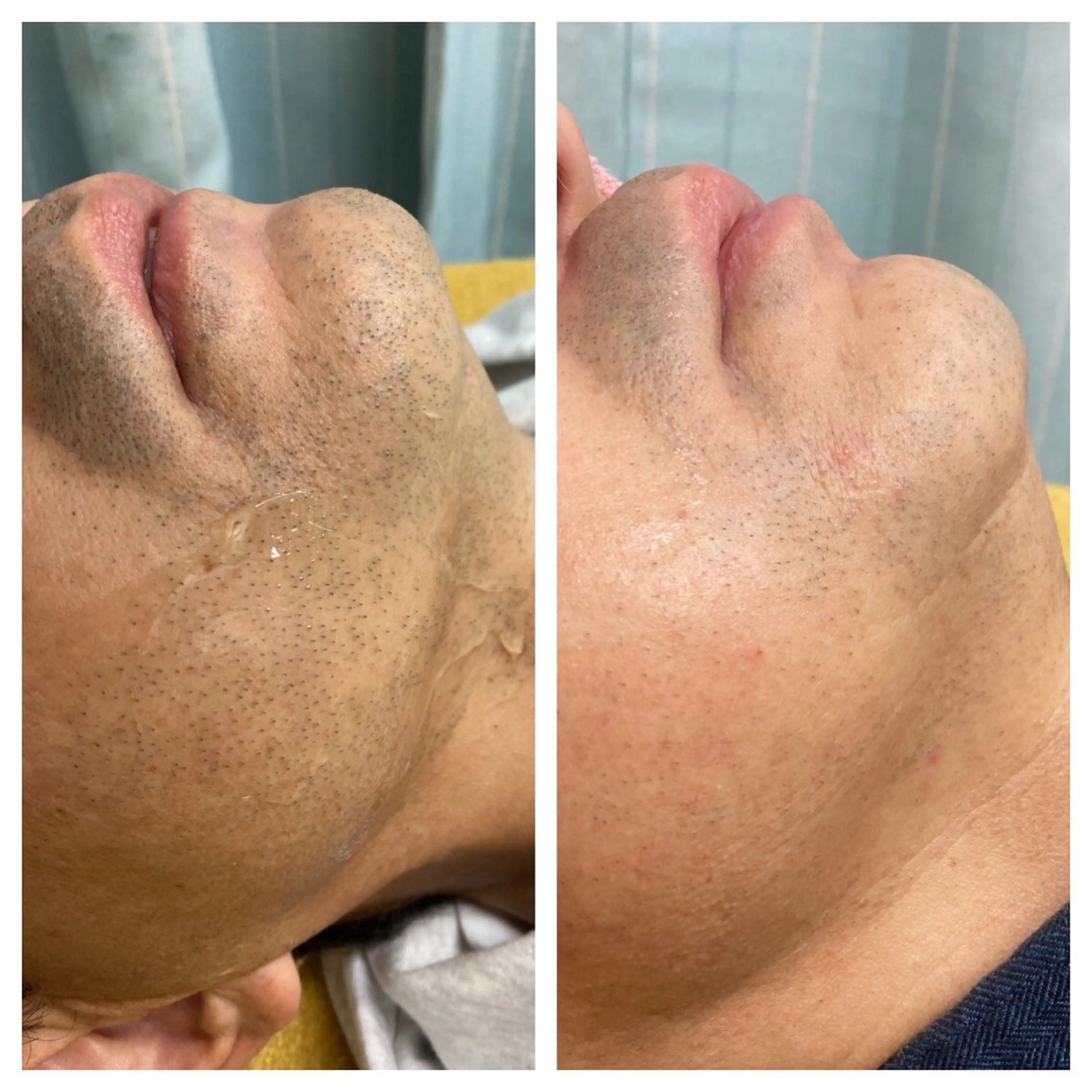 たにがわ整骨院　　salon  de  epila所属・salon   de epilaのエステ・リラクイメージ