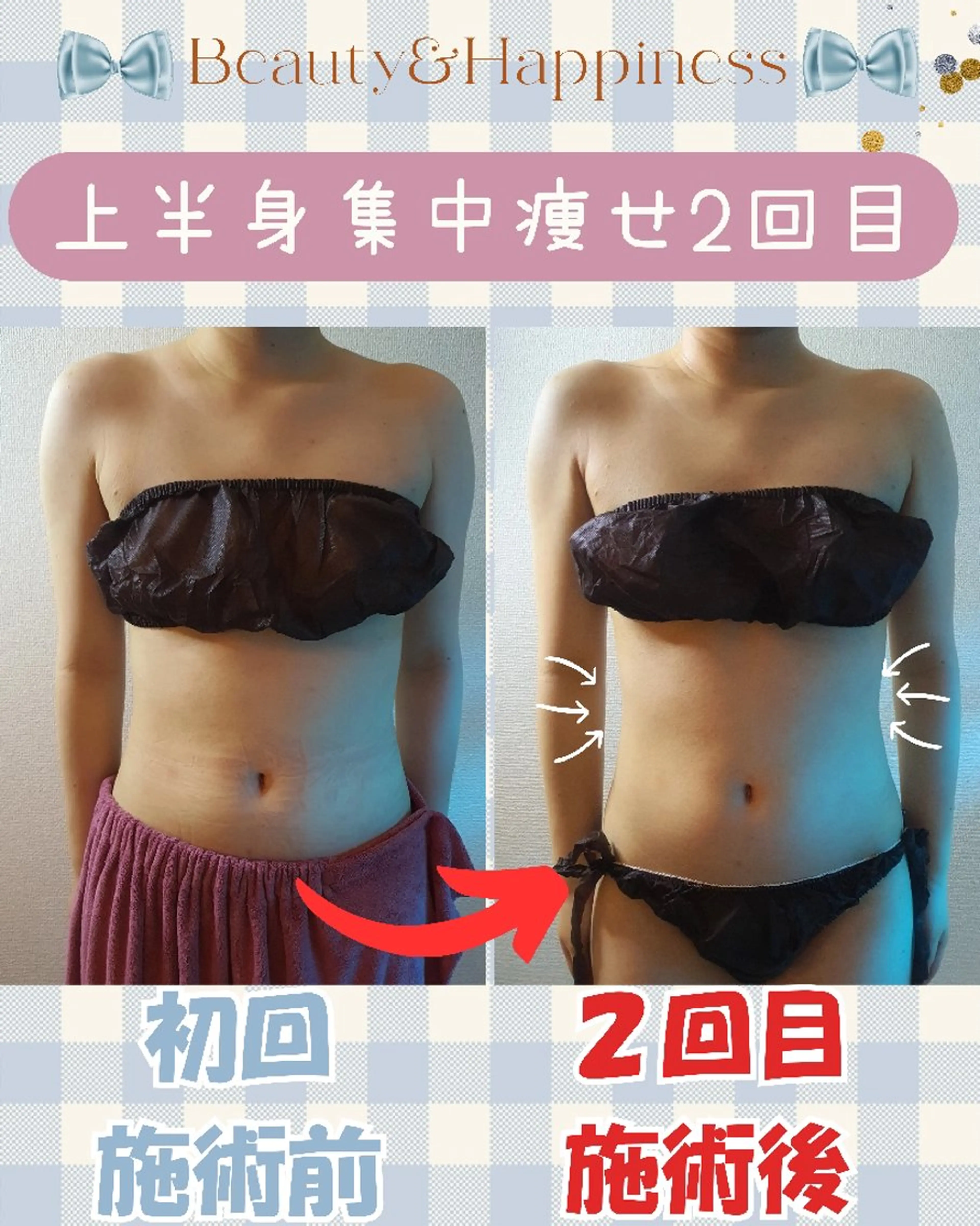 痩身ハーブピーリング 筋膜リリース☆B&Hのエステ・リラクイメージ