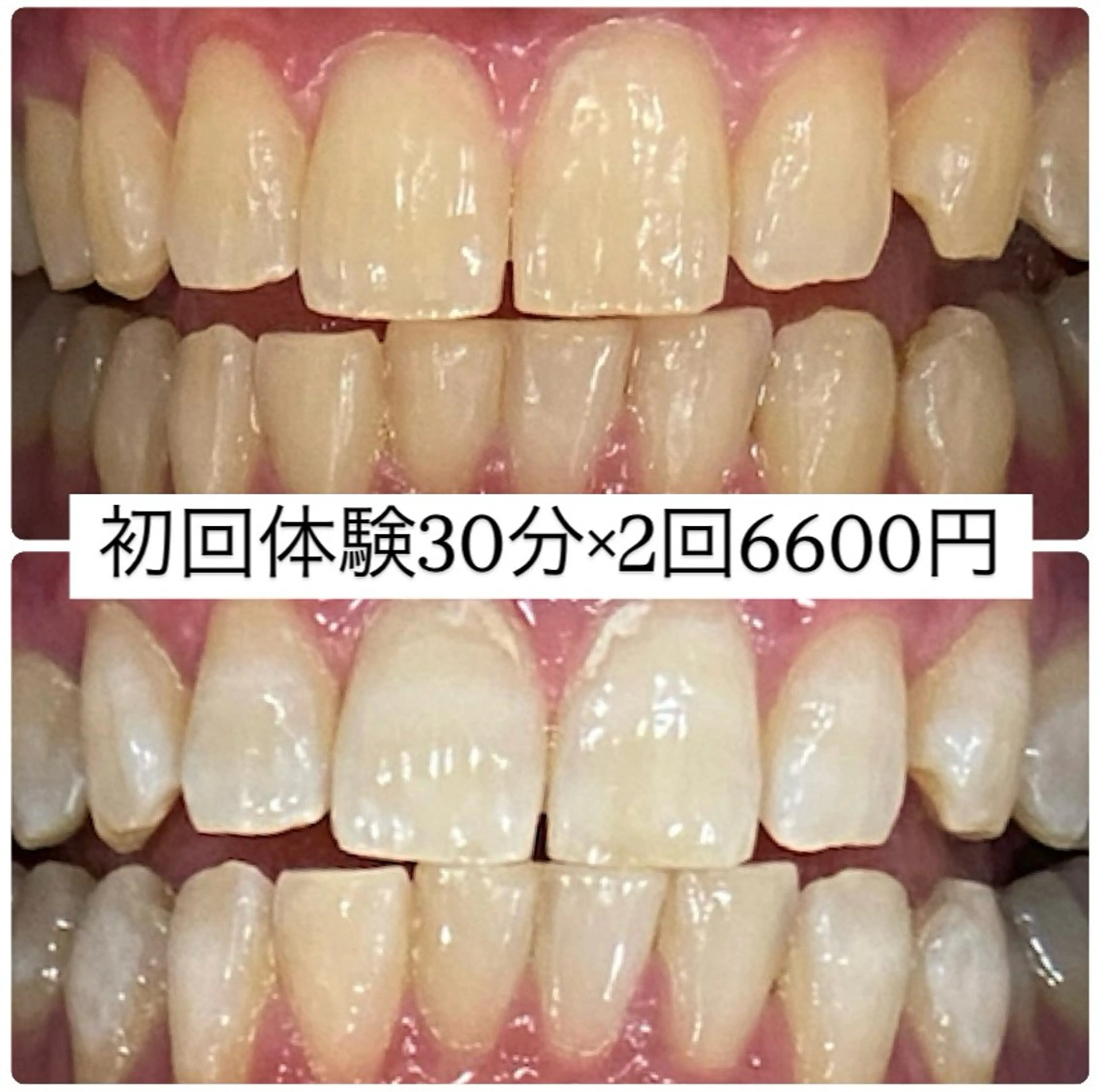 PLATINUM Beauty 横浜店所属・ホワイトニングルーム 横浜店のその他イメージ