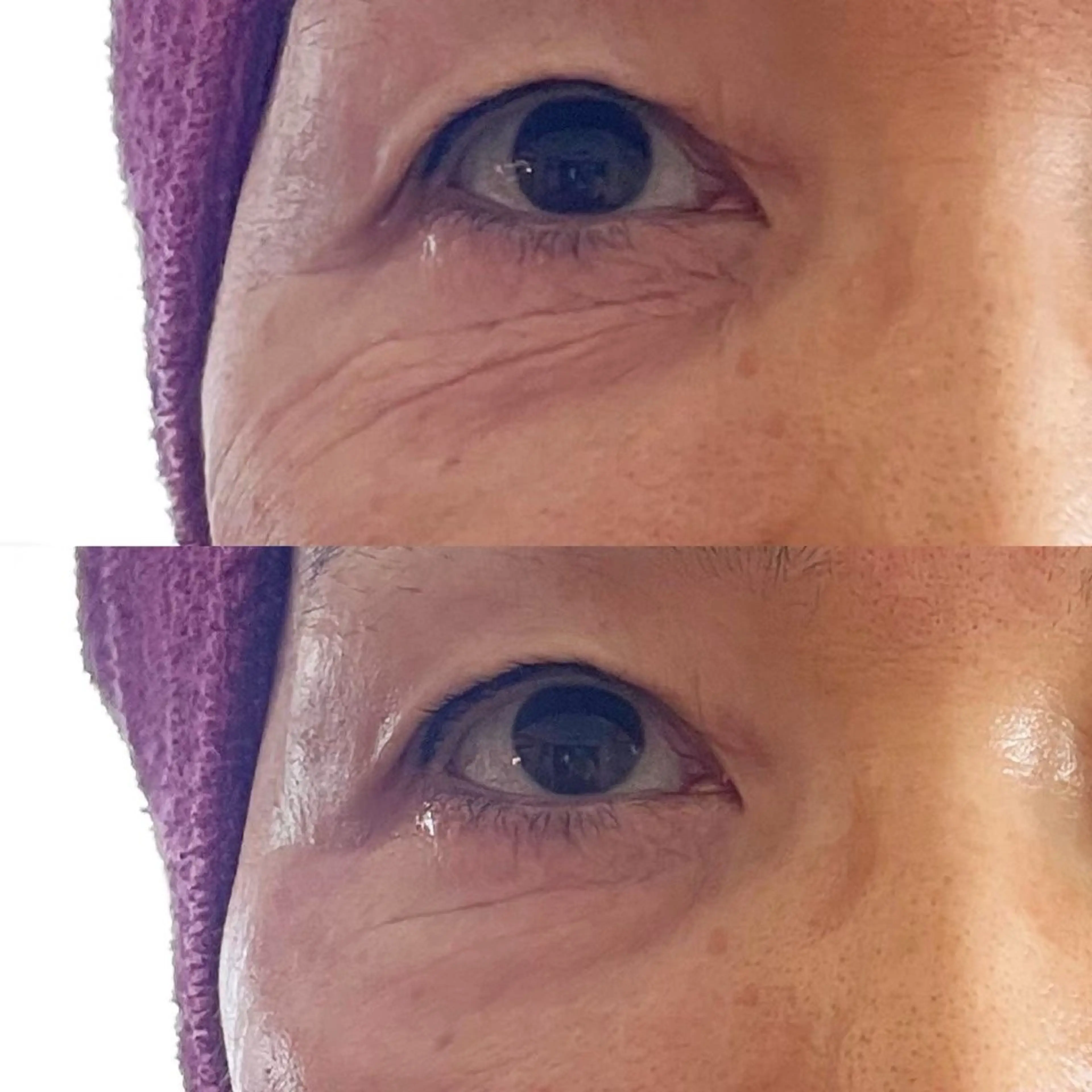 Harry•ハリー🩵韓国コルギとヘアラインのお店所属・韓国肌管理HARRY ・ハリー🤍大村のエステ・リラクイメージ