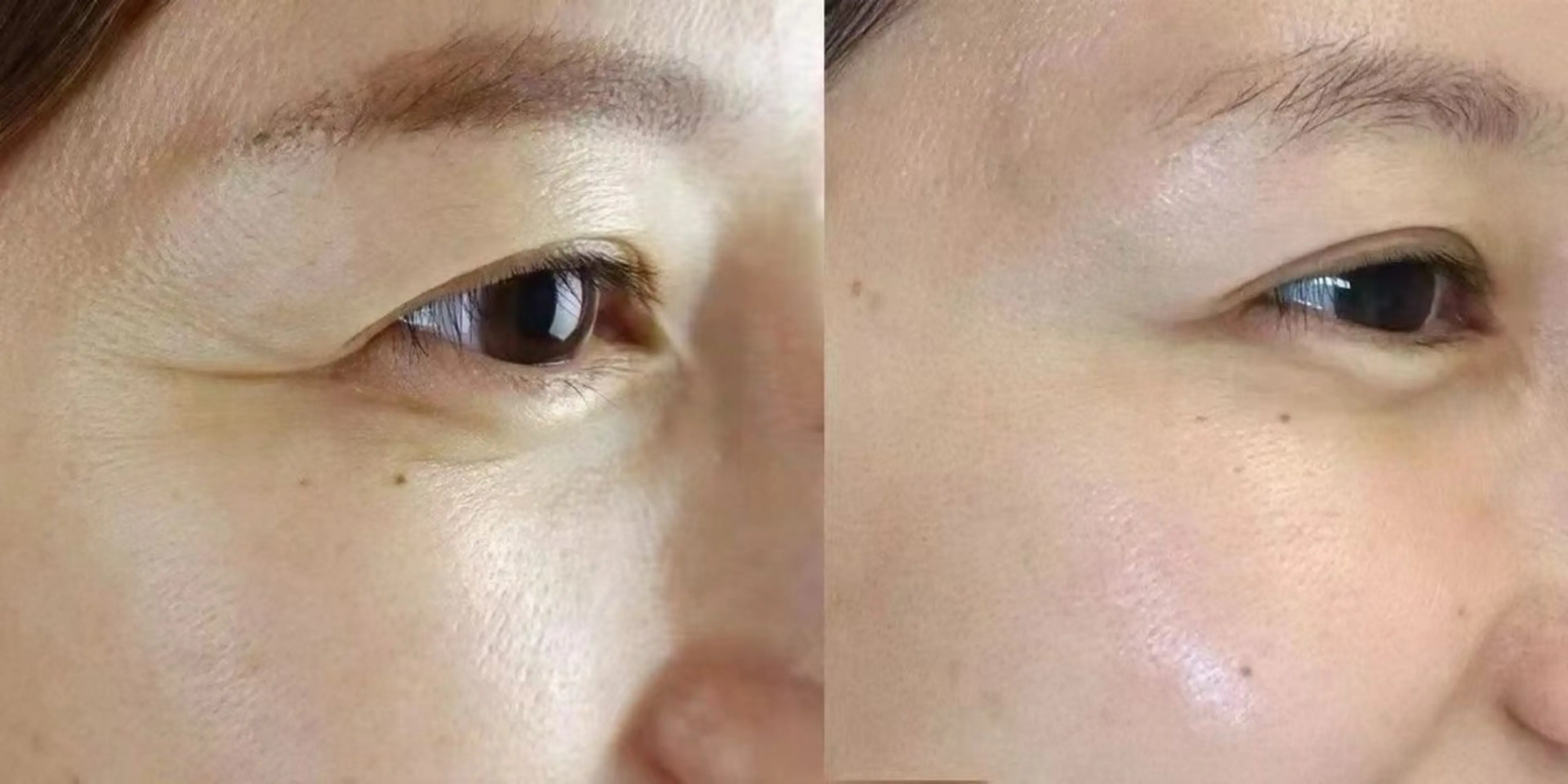 マツエク・マツパ エステ aliaハイフ&水光ジェットサロン所属・aliaハーブ水光店 エステティシャン募集のエステ・リラクイメージ