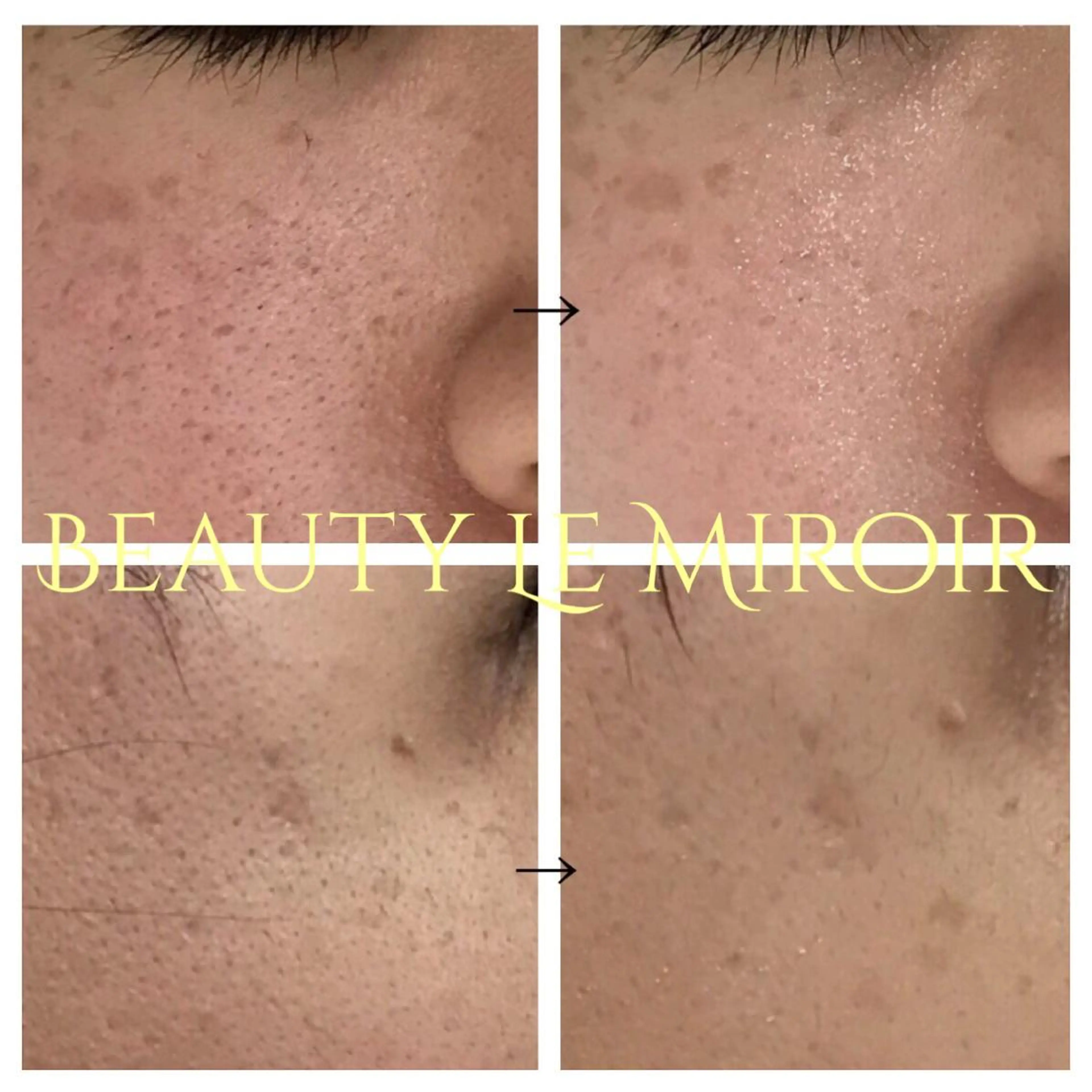 ビューティー ミロワールのエステ・リラクイメージ