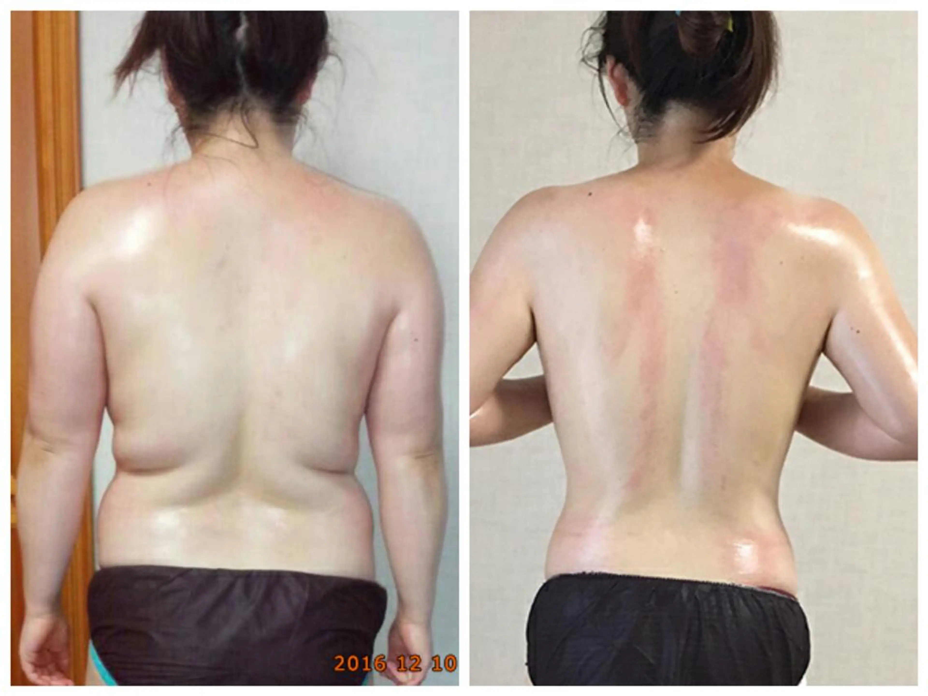 美肌脱毛専門店 イオンモール春日部店のエステ・リラクイメージ