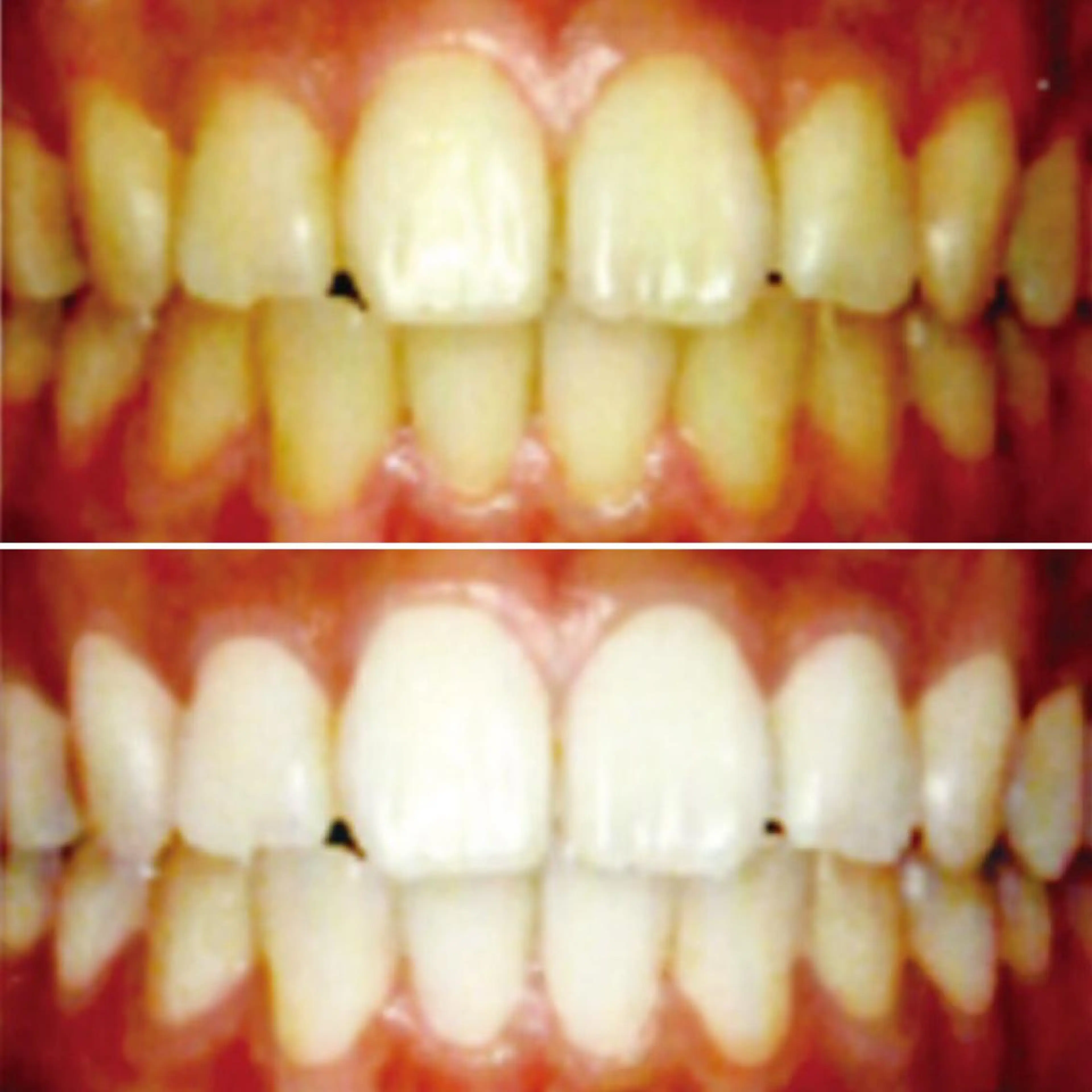 その他 WhiteningSquare by Avanti所属・ホワイトニングスクエ ア by アバンティのその他イメージ