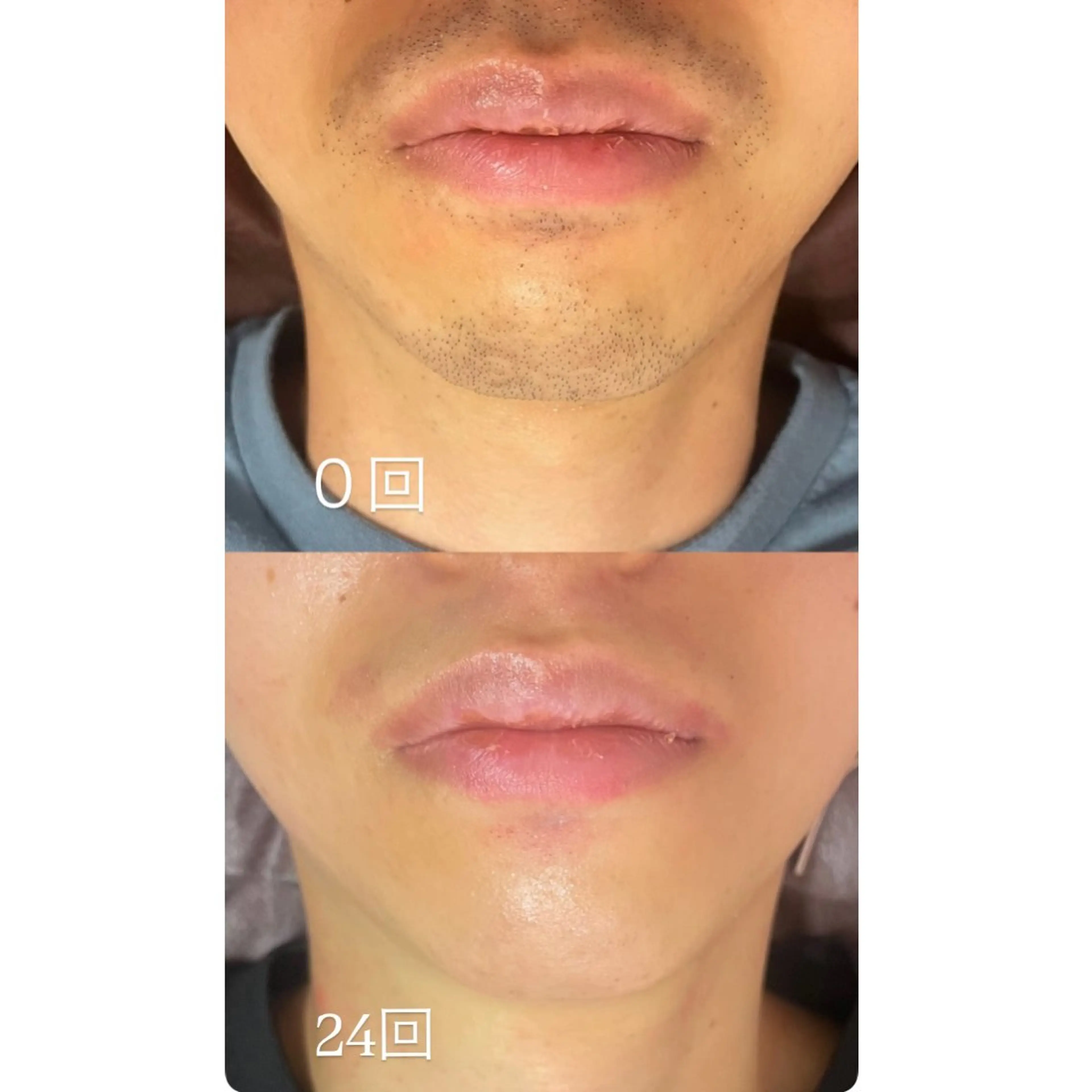 津田沼店 Earthのエステ・リラクイメージ