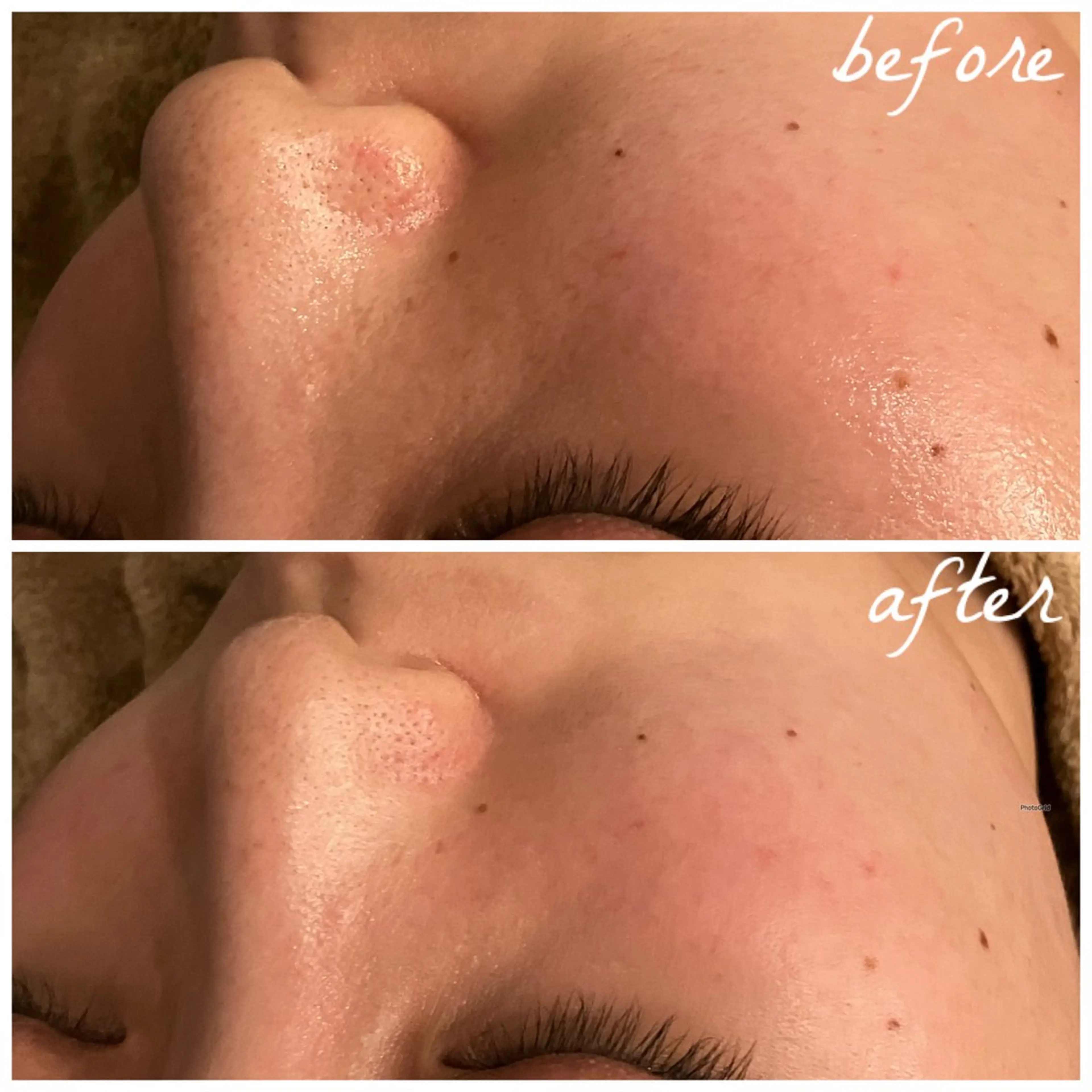 メンズ エステ メナード岐阜茜部 杉浦のエステ・リラクイメージ