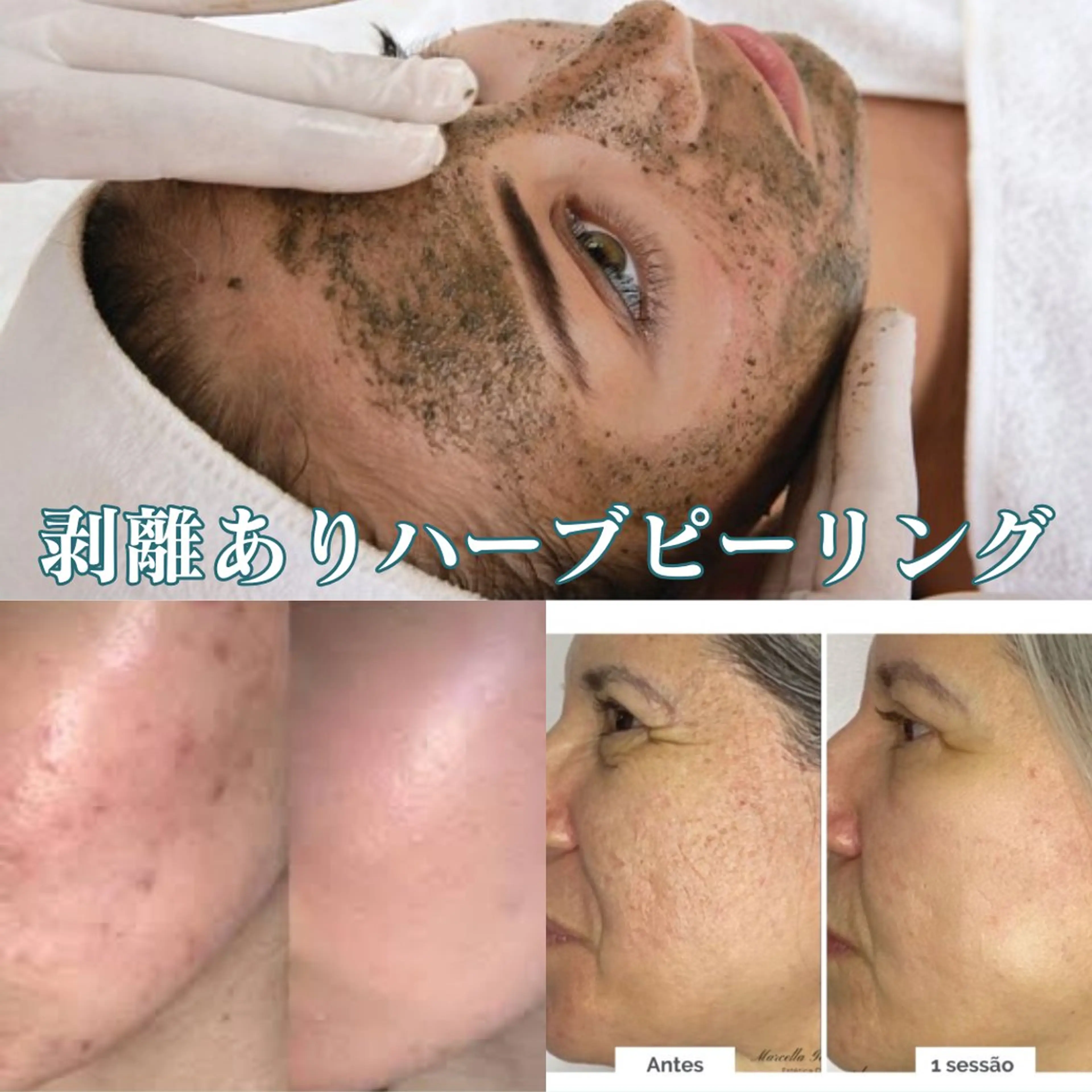 エステ BestBelleꕤ 大阪福島/肌質改善のエステ・リラクイメージ