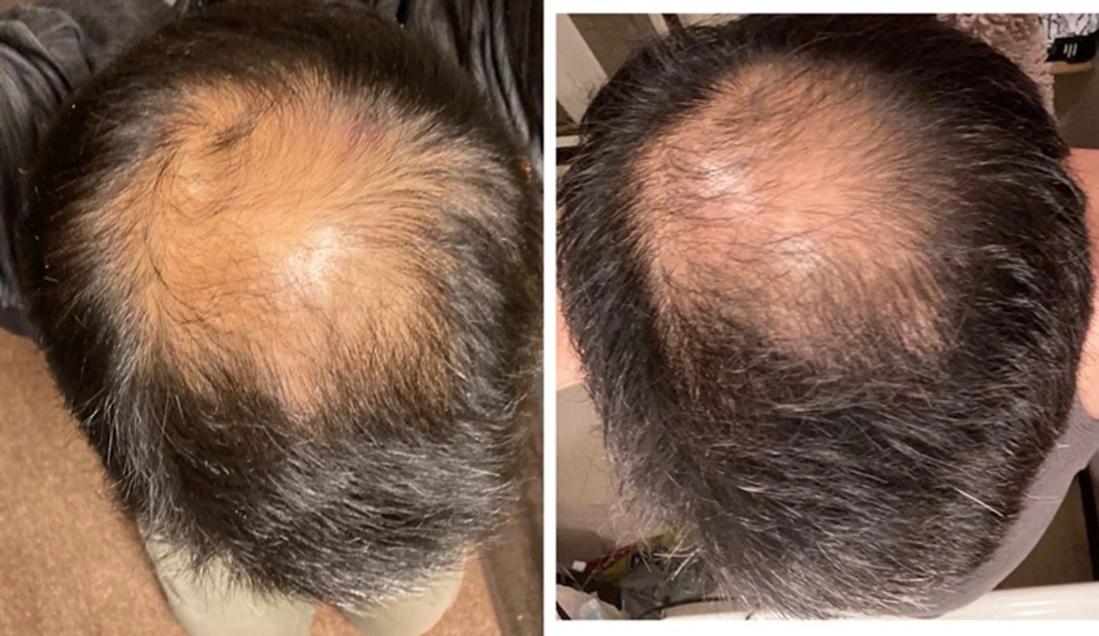 MARIRE EPISALONのエステ・リラクイメージ