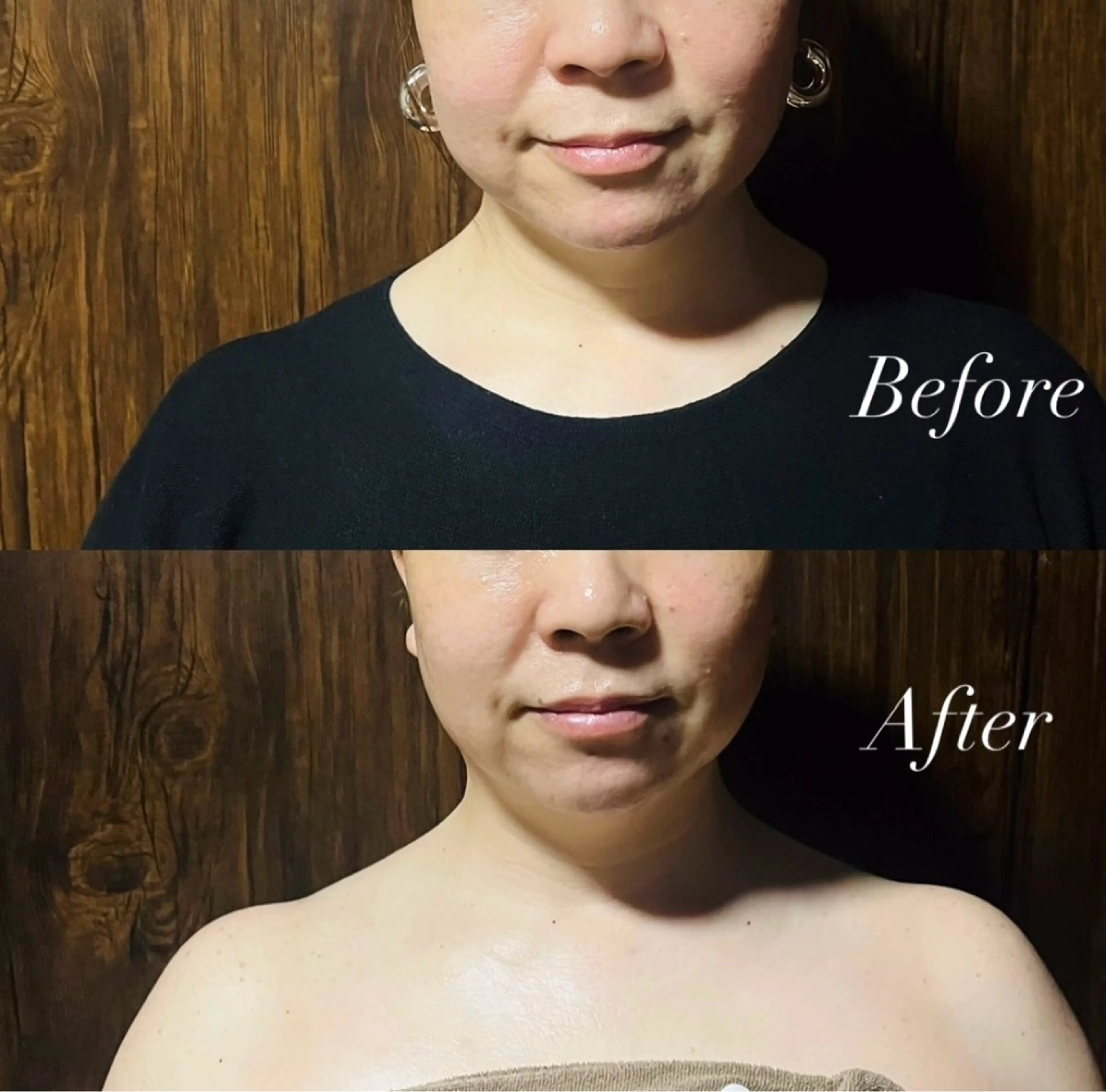 Lim(ライム)樋口 フェイシャル・ボディのエステ・リラクイメージ