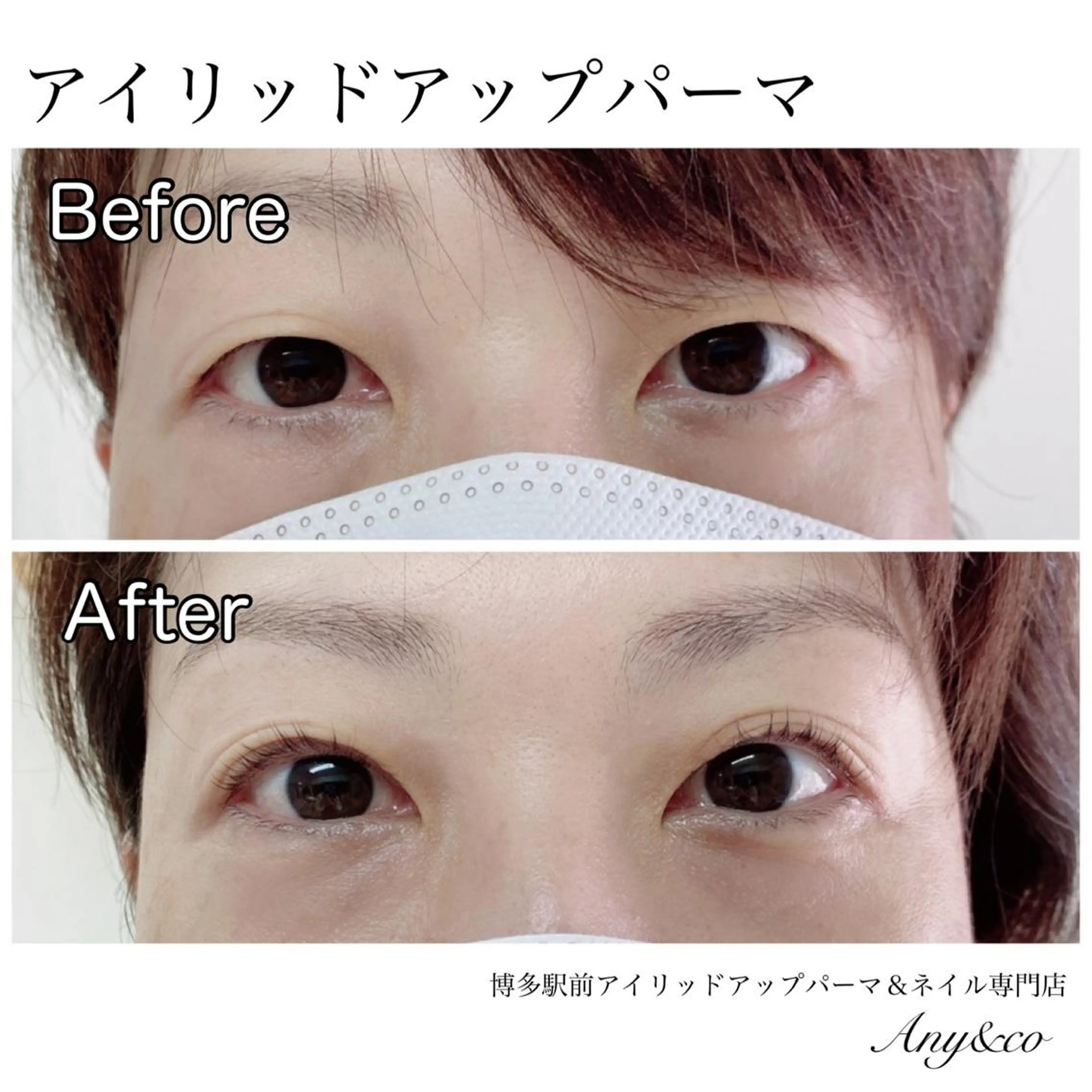 マツエク・マツパ アイリッドアップパーマ 一重×まつ毛パーマ Any&co 【エニコ】のマツエク・マツパデザイン