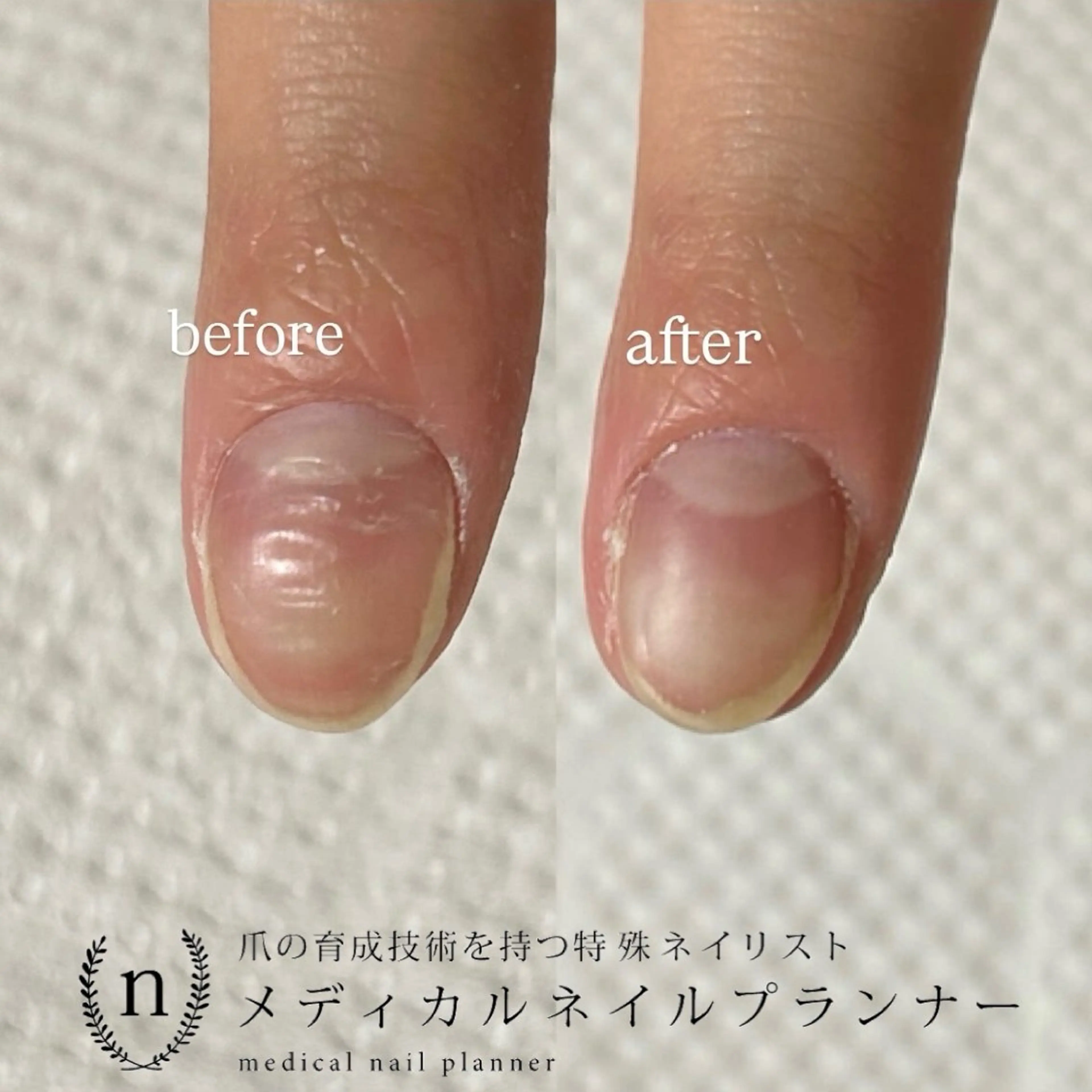 ネイル ハンドネイル Lofinails ちひろのネイルデザイン