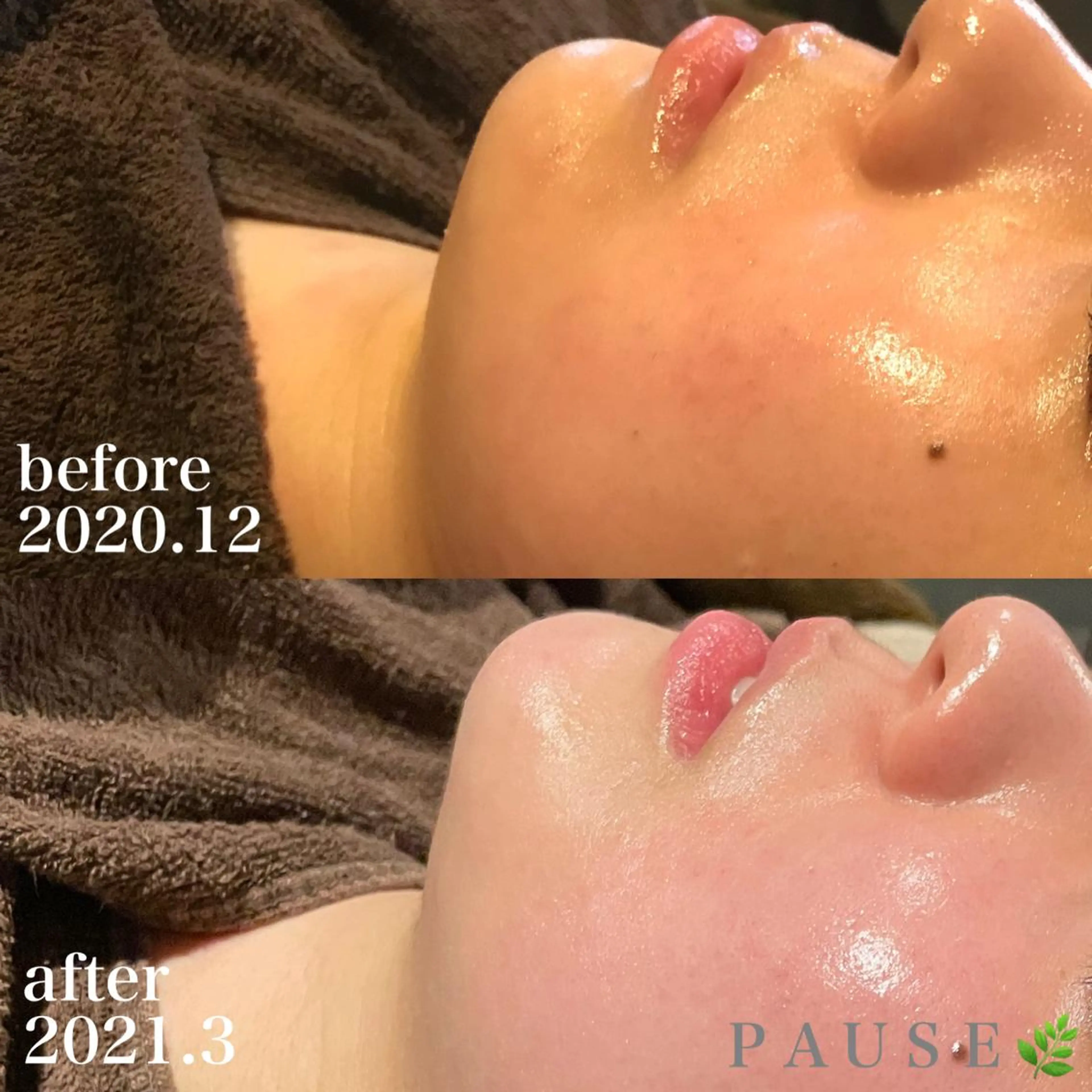 エステ 浜野 恵美のエステ・リラクイメージ