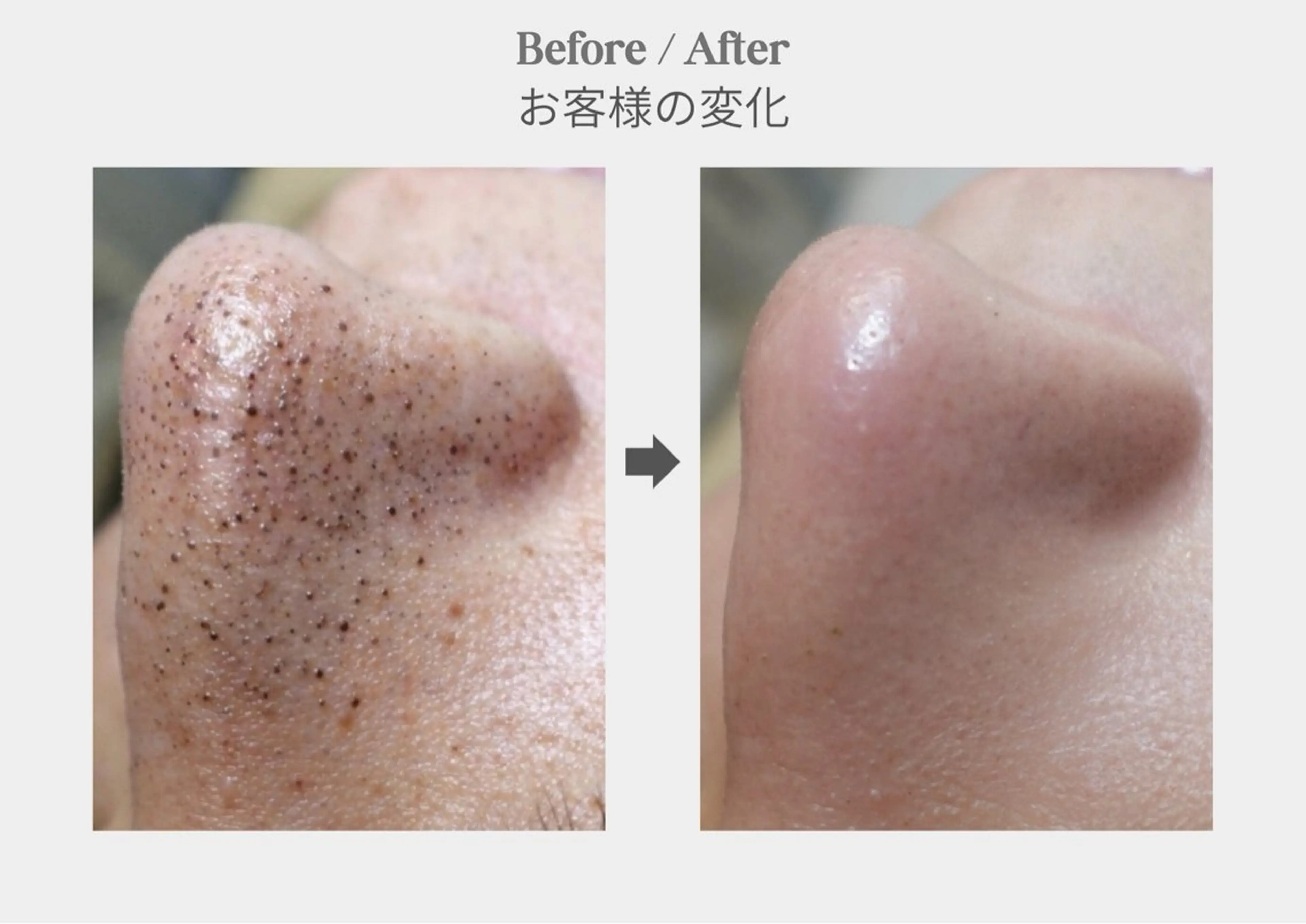 エステ 韓国肌管理Belle   新橋所属・店長 RUNAのエステ・リラクイメージ