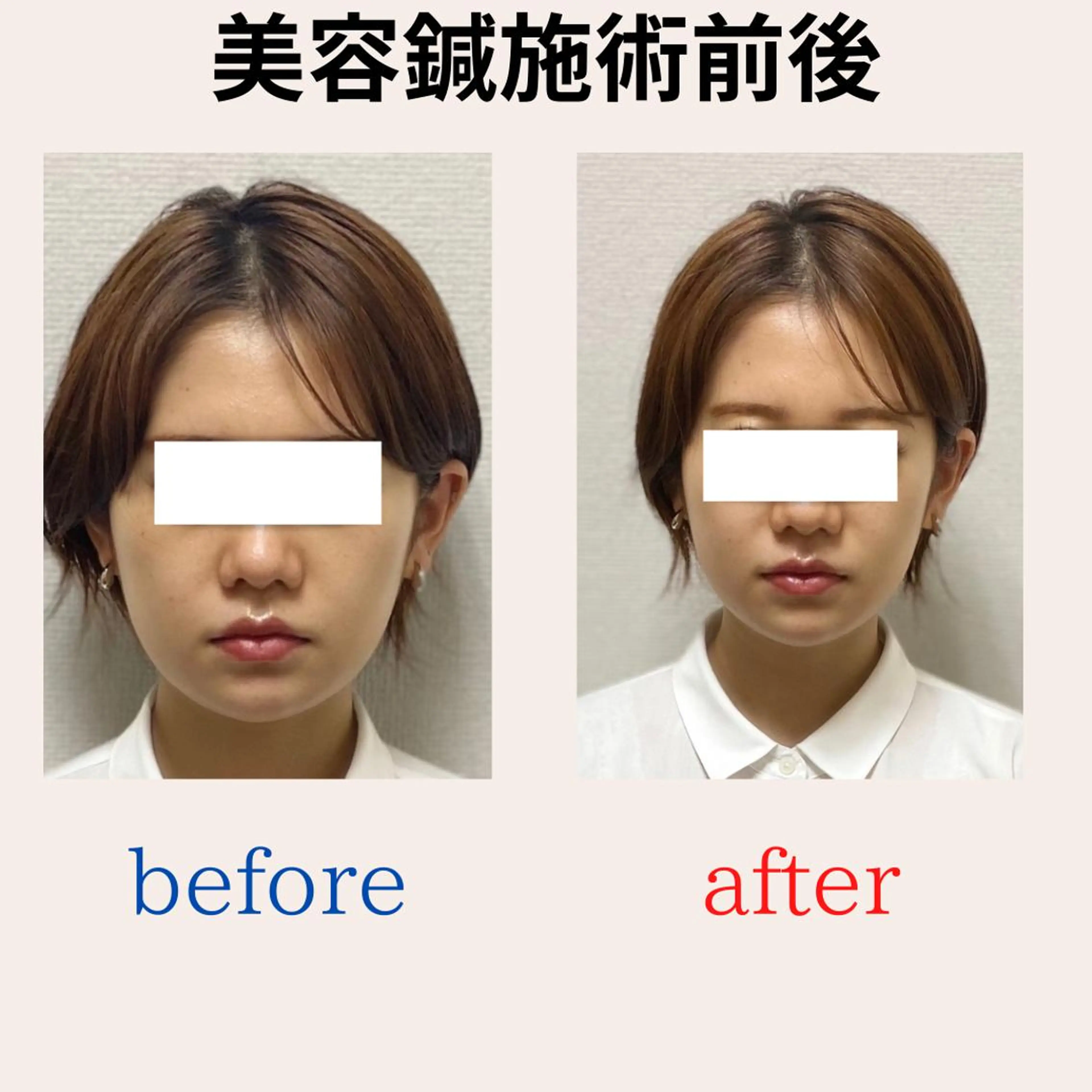 BEAUTY&HEALTH鍼灸院【春日部筋膜整体タケダ整体院】所属・武田 紘輝のエステ・リラクイメージ