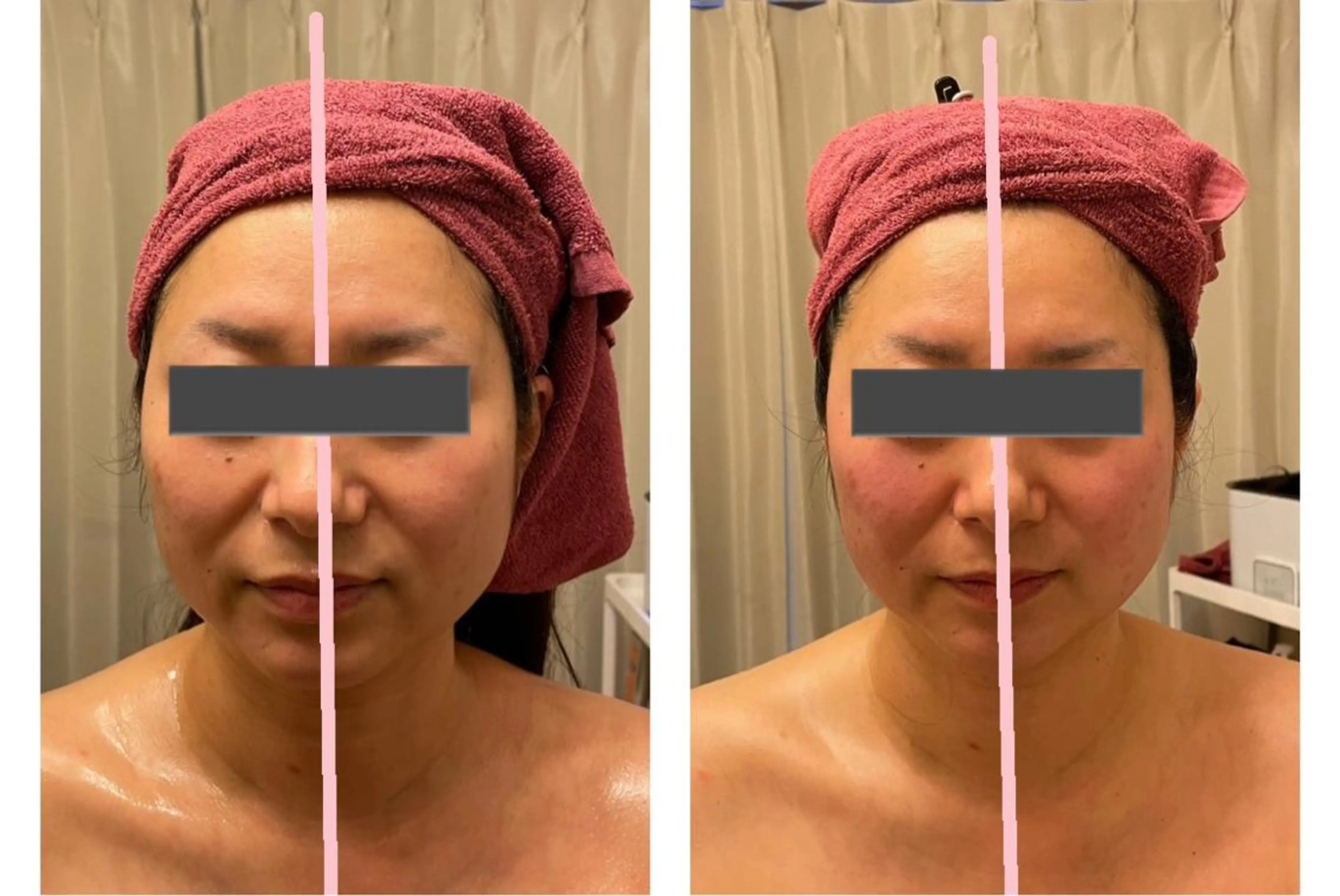 糸島 エステサロンmiuのエステ・リラクイメージ