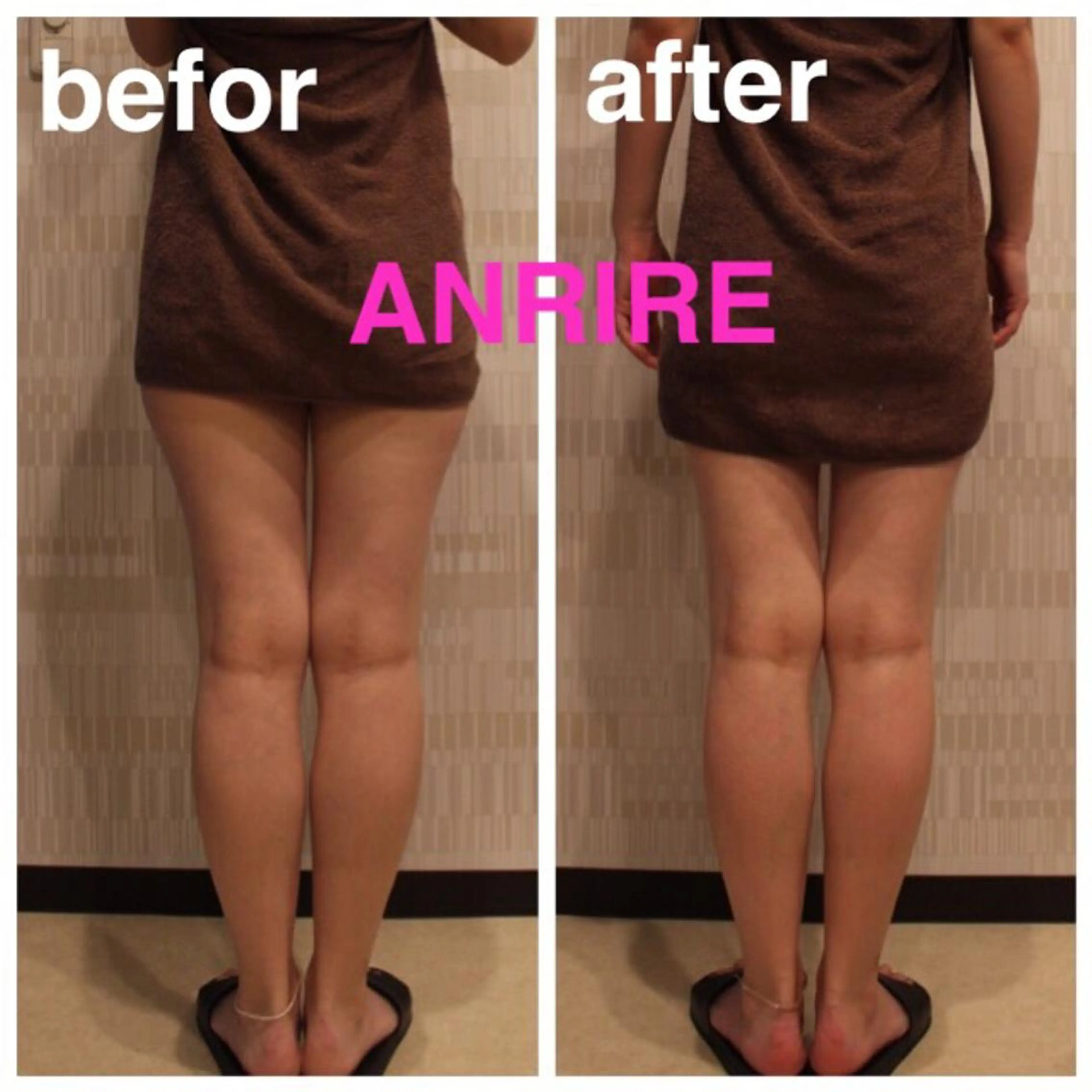 ANRIRE (アンリール)のエステ・リラクイメージ