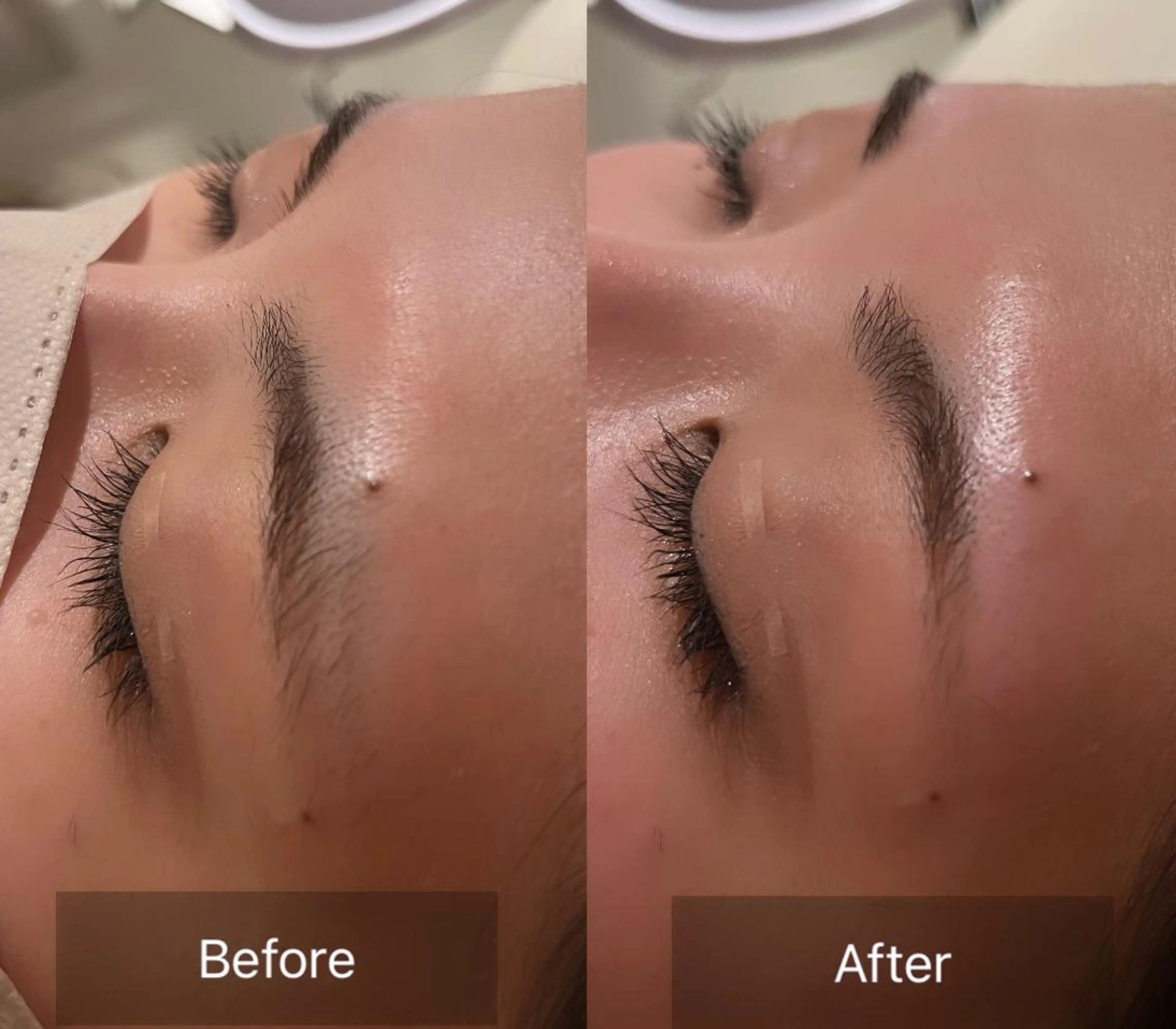 アイブロウ 眉毛ワックス脱毛 for woman所属・森 美優のエステ・リラクイメージ