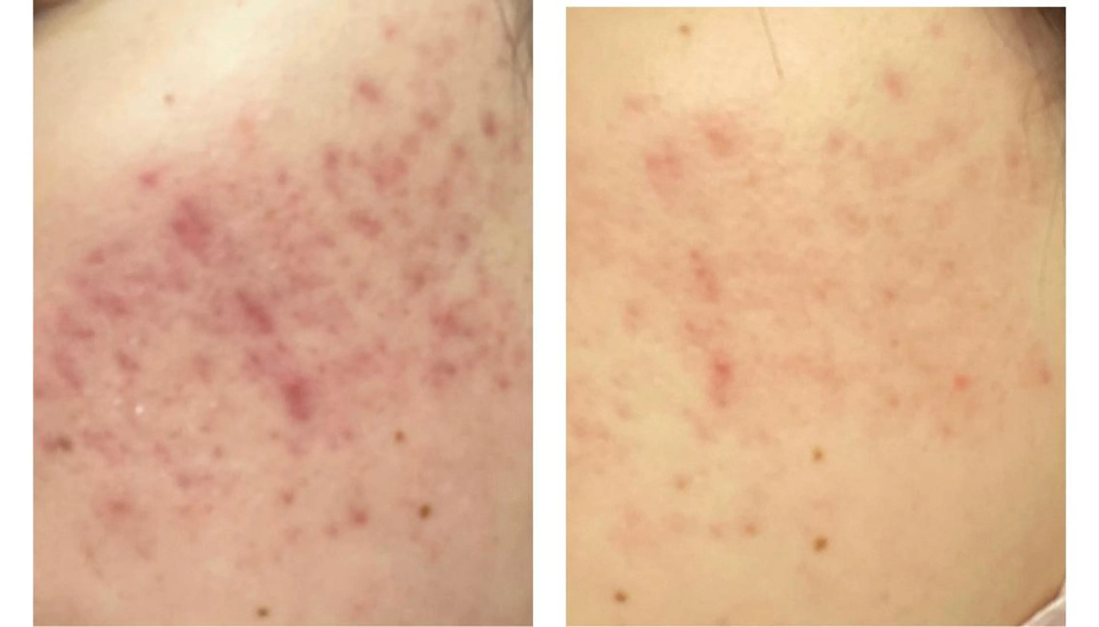 セミロング カラー パーマ ヘアアレンジ メンズ キッズ ネイル マツエク・マツパ アイブロウ ニキビ特化型エステ 🍓最短で肌質改善のエステ・リラクイメージ