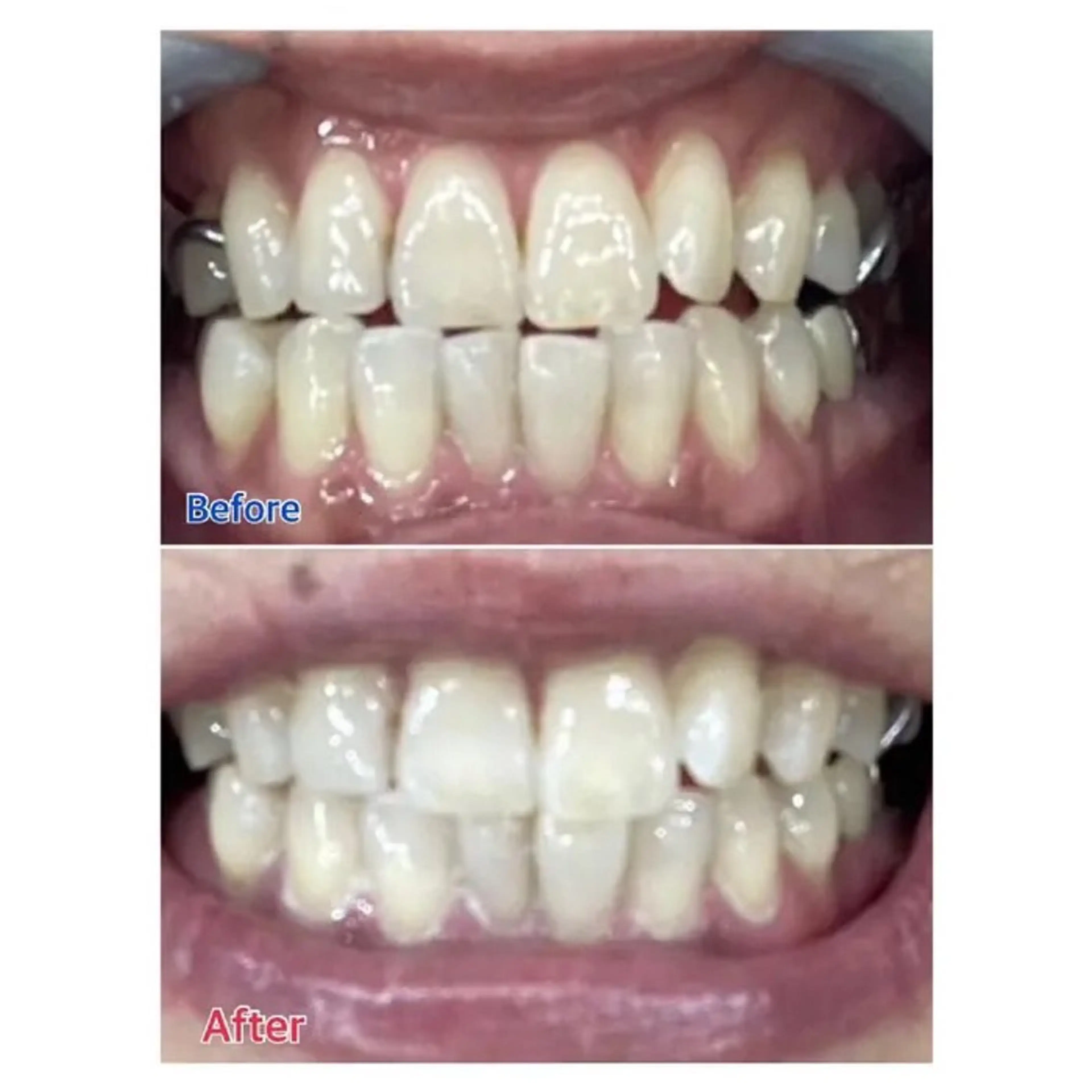 M渋谷店所属・Ｍ渋谷 ホワイトニングのその他イメージ