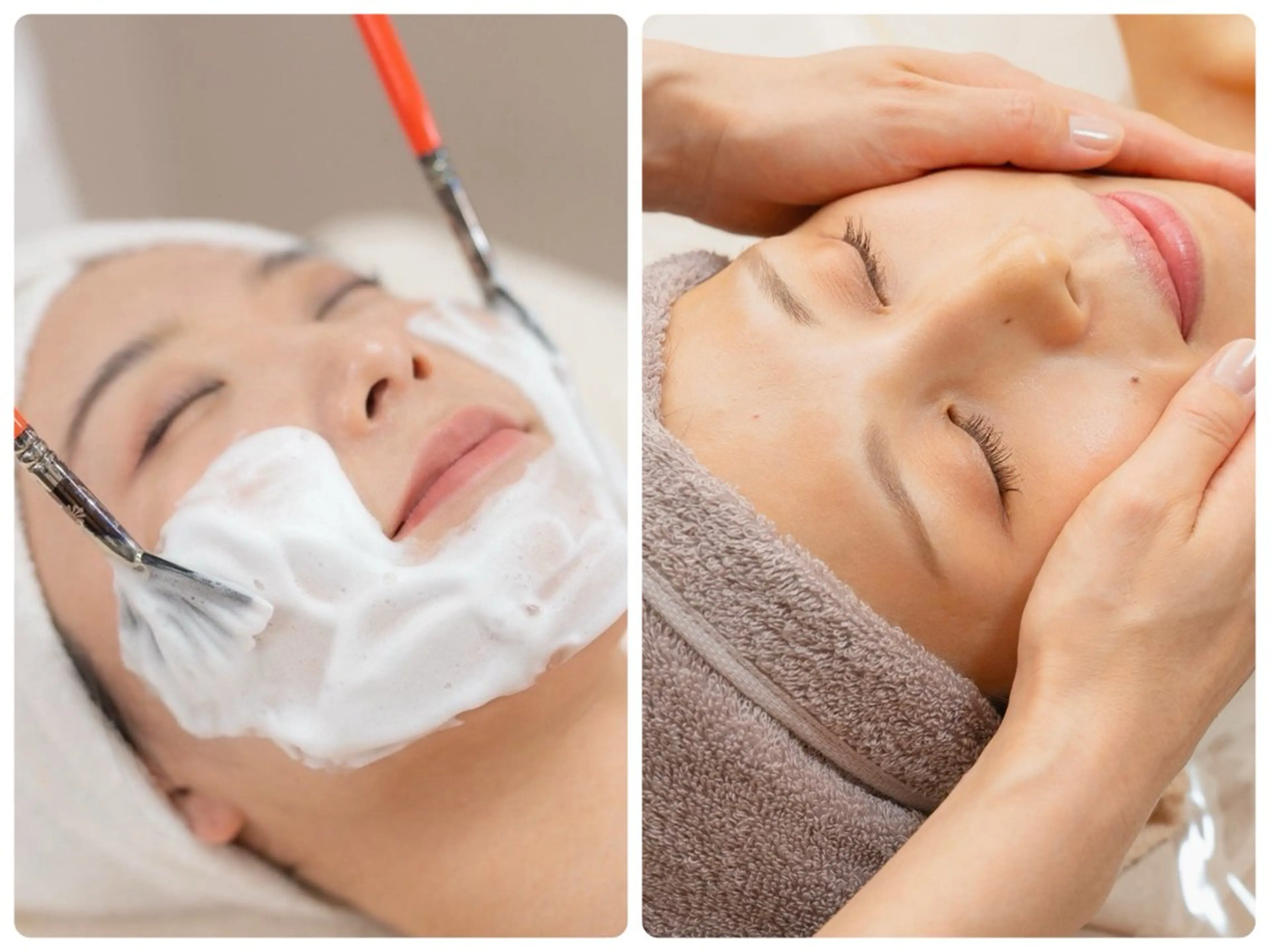 ララピール+ヒト幹細胞導入￥22000→の写真