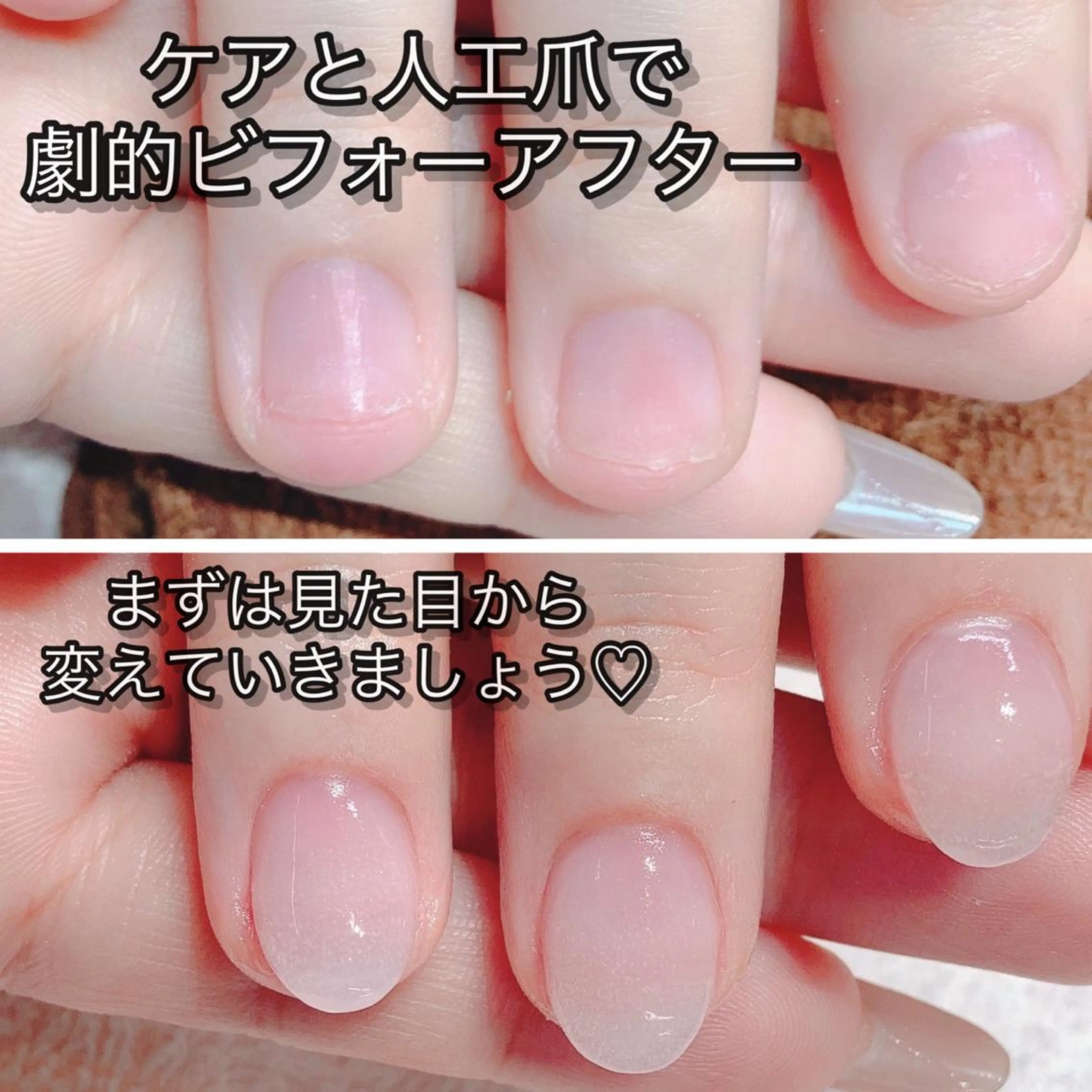 ネイル ハンドネイル Nail×Lani 深爪矯正対応◎のネイルデザイン