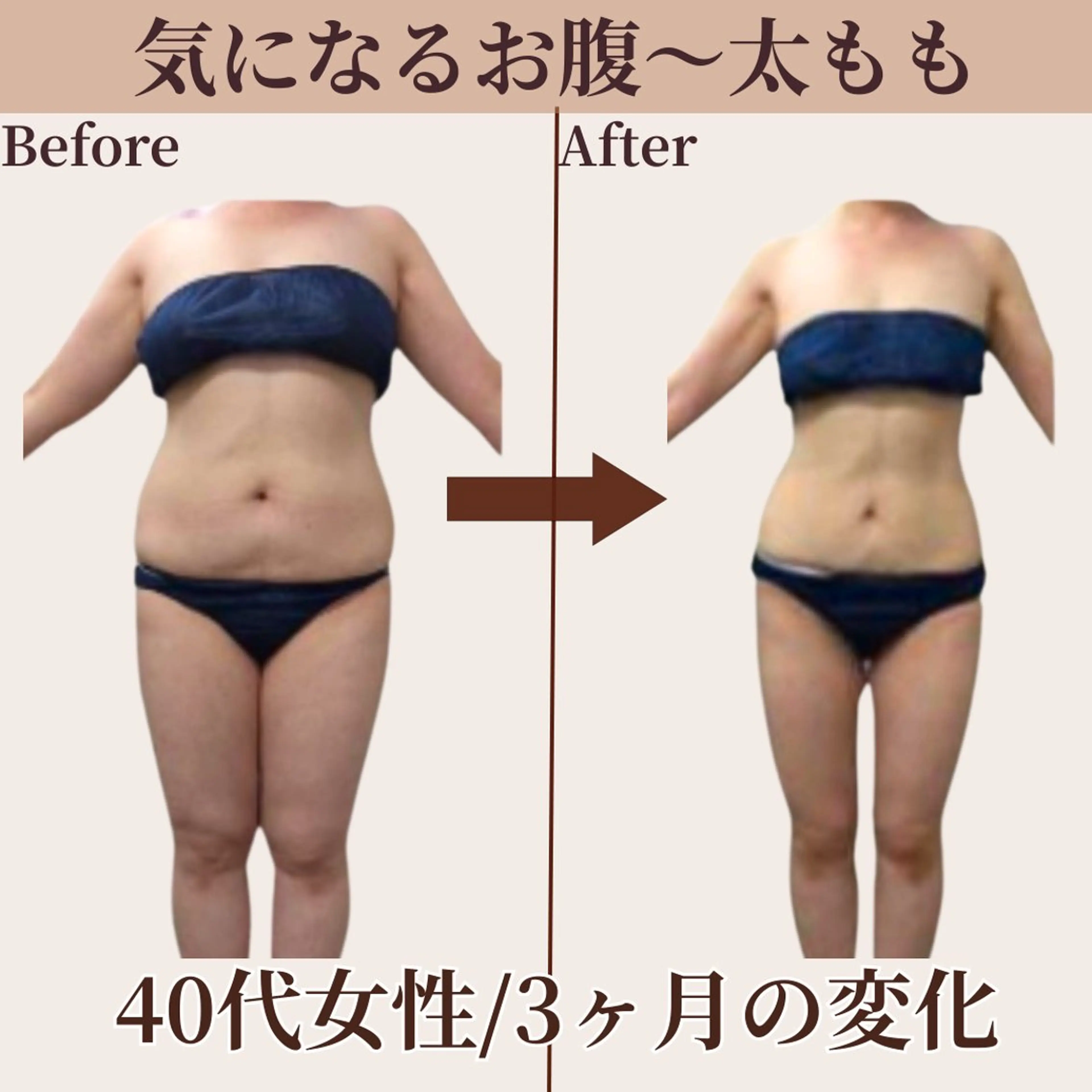 【中胴体☆集中】贅肉撃退痩身/着たい服を着こなす♪悩み深いお腹/お尻/太もも/前ハリに★《初回限定💫特別価格》の写真