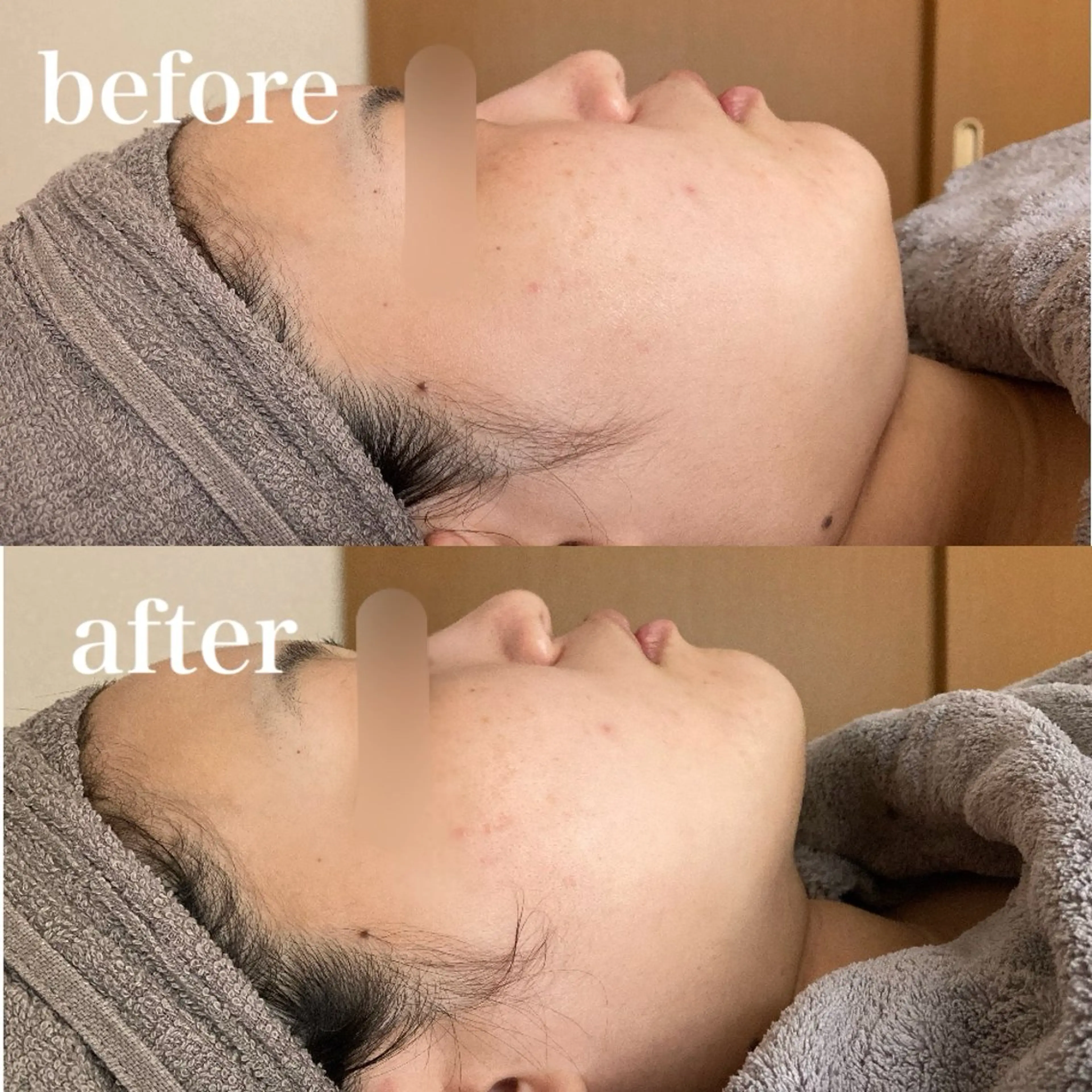 磐田｜LAYLA 一番丁寧な脱毛店のエステ・リラクイメージ