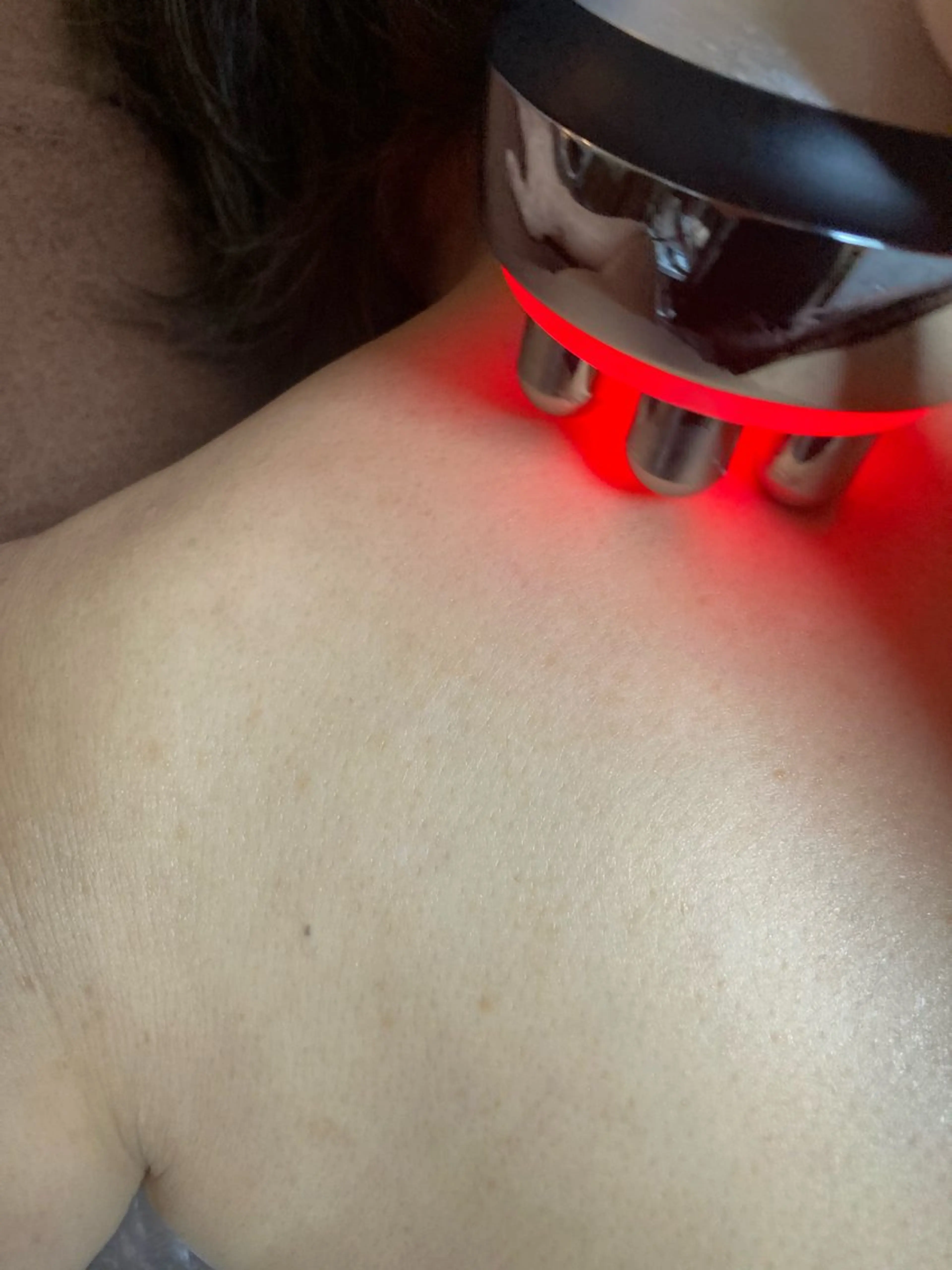 お腹周り痩身！気になるお腹周りのセルライト。キャビテーションとラジオ波でアプローチ。最後に人気のEMS付き。の写真