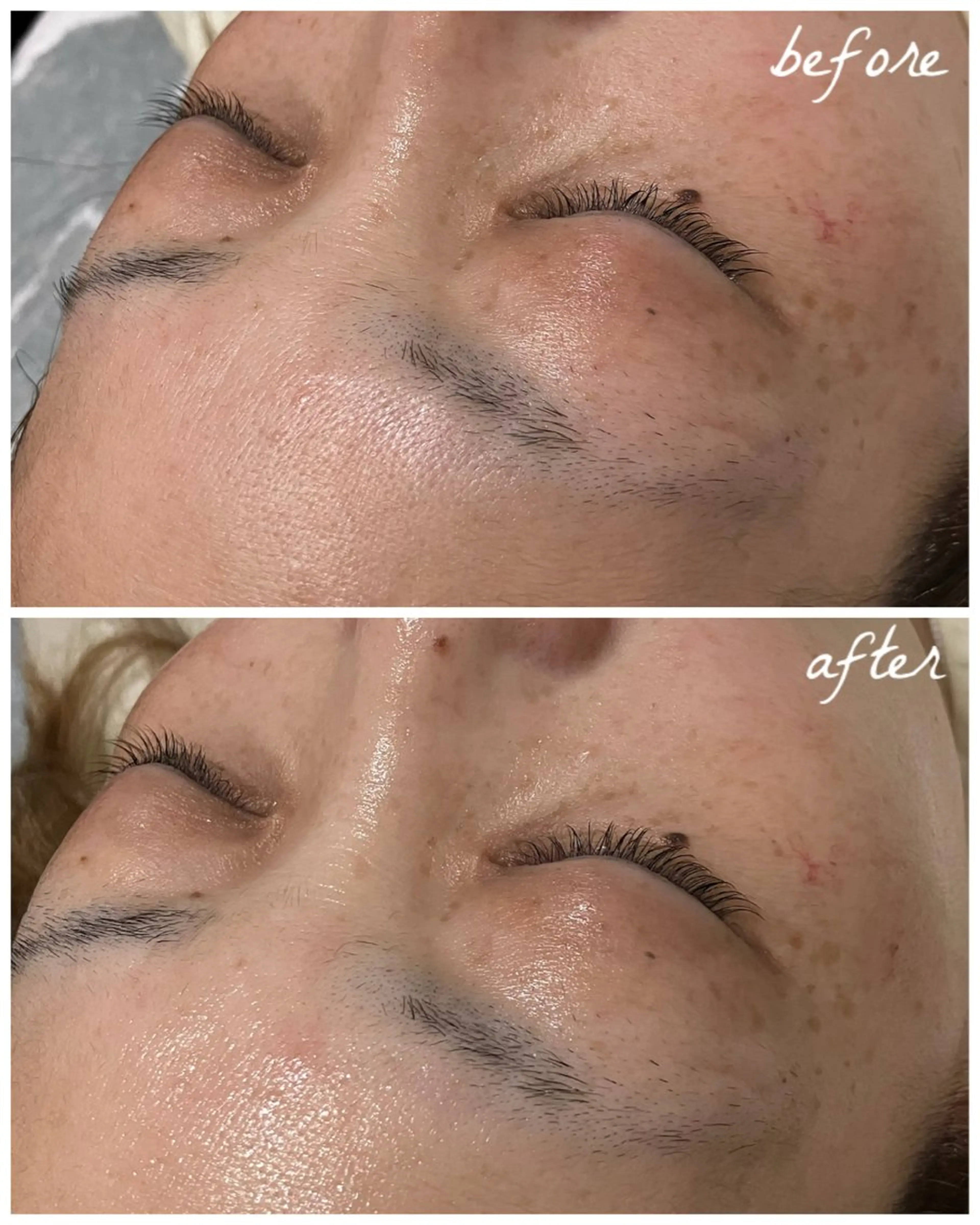 メンズ エステ メナード岐阜茜部 杉浦のエステ・リラクイメージ