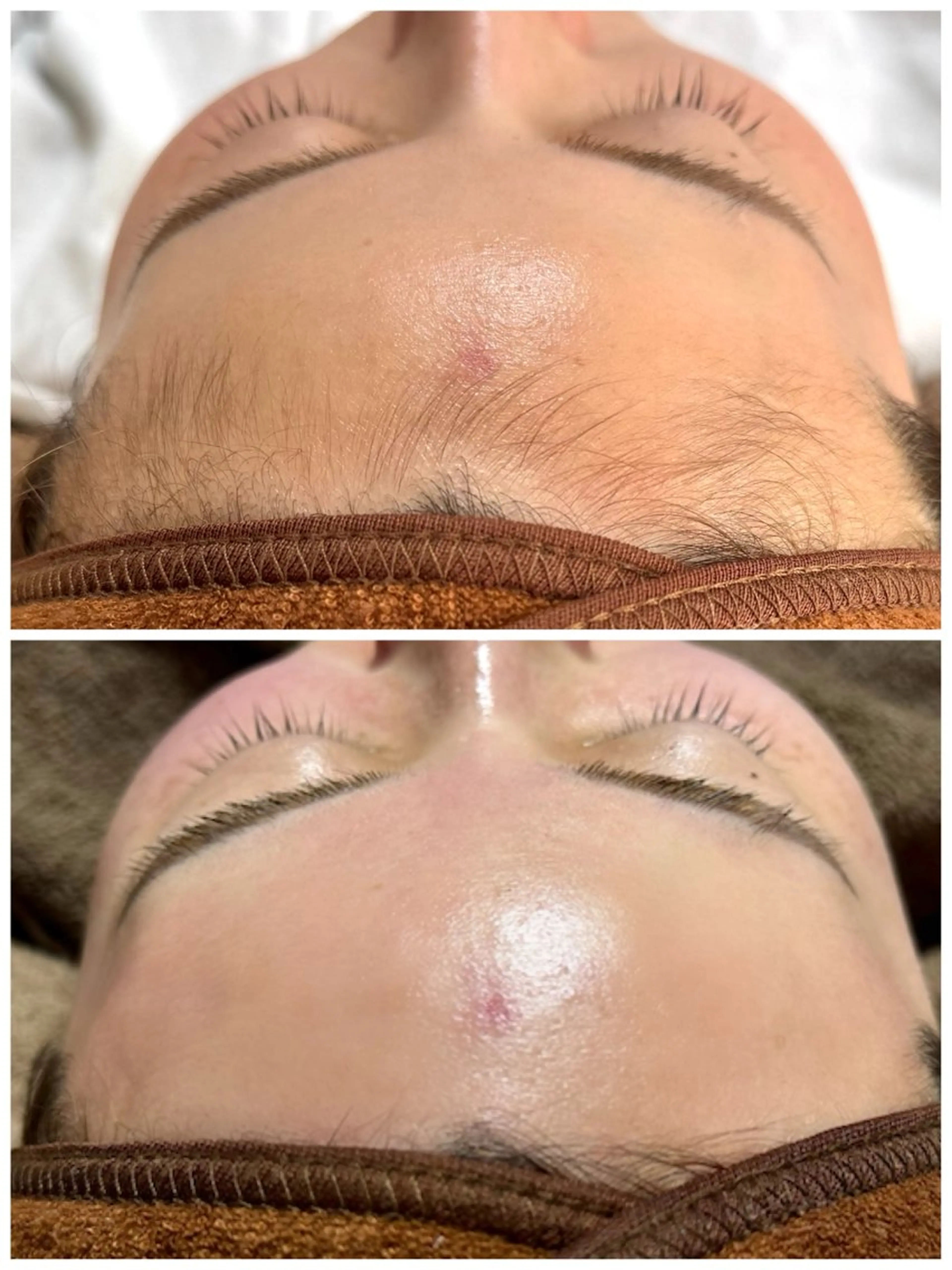 《ミニモ限定価格❤️‍🔥》お得なセットメニュー✨フェイシャル&うなじワックス脱毛🌿 ※当日予約不可※注意事項必読の写真