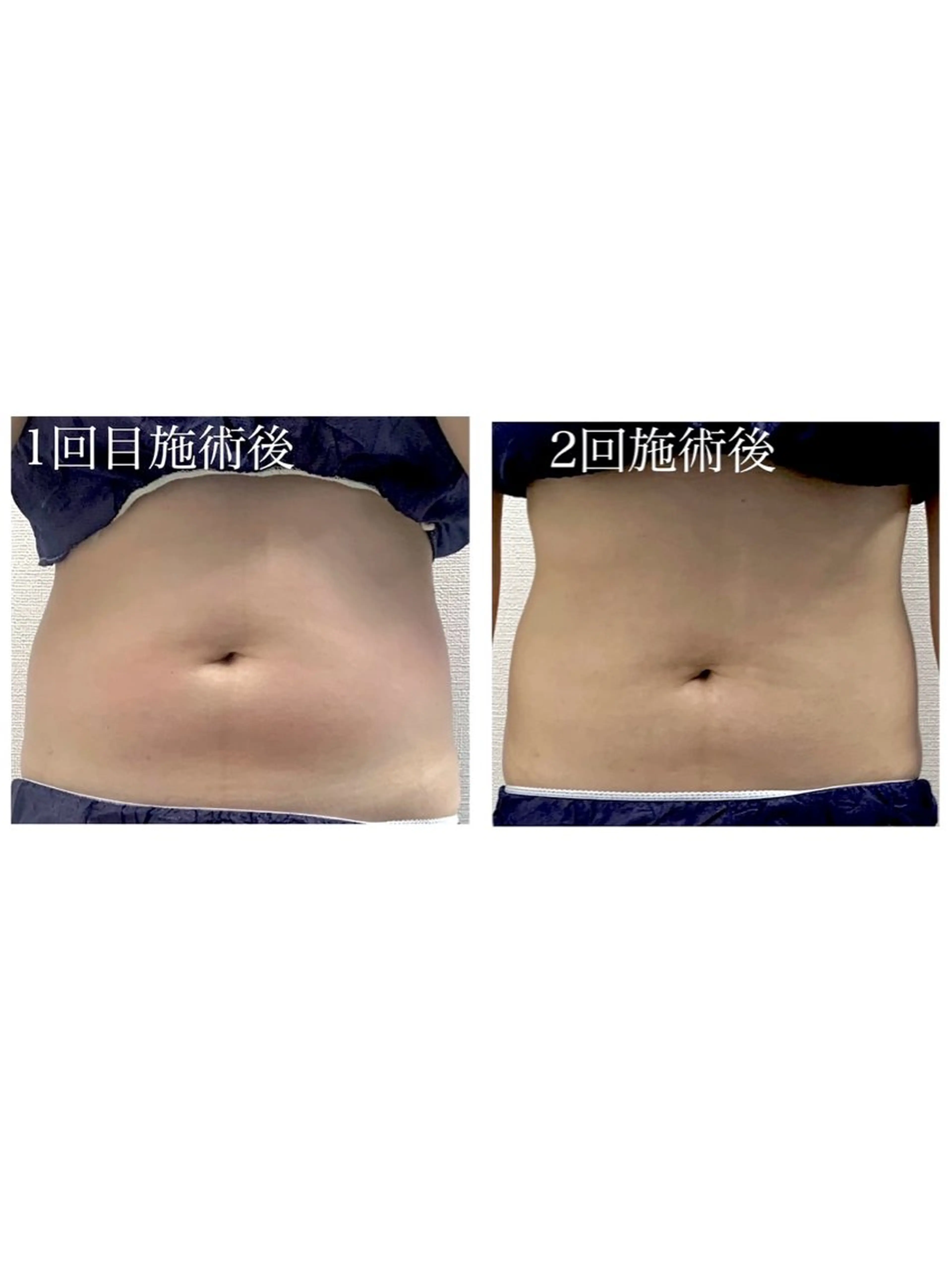 Genesis Plus大津京店のエステ・リラクイメージ