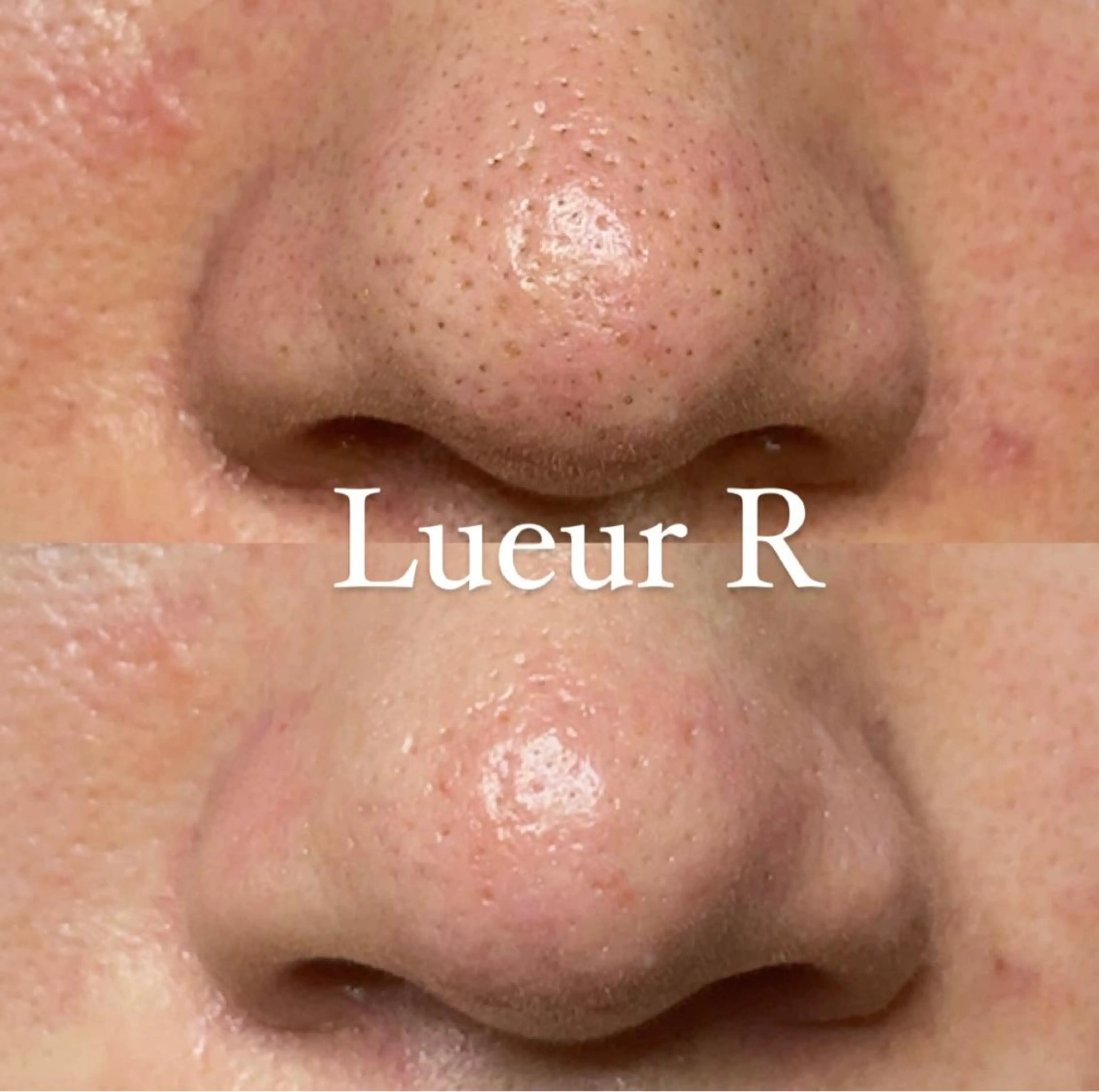 エステ 大久保 里奈のエステ・リラクイメージ