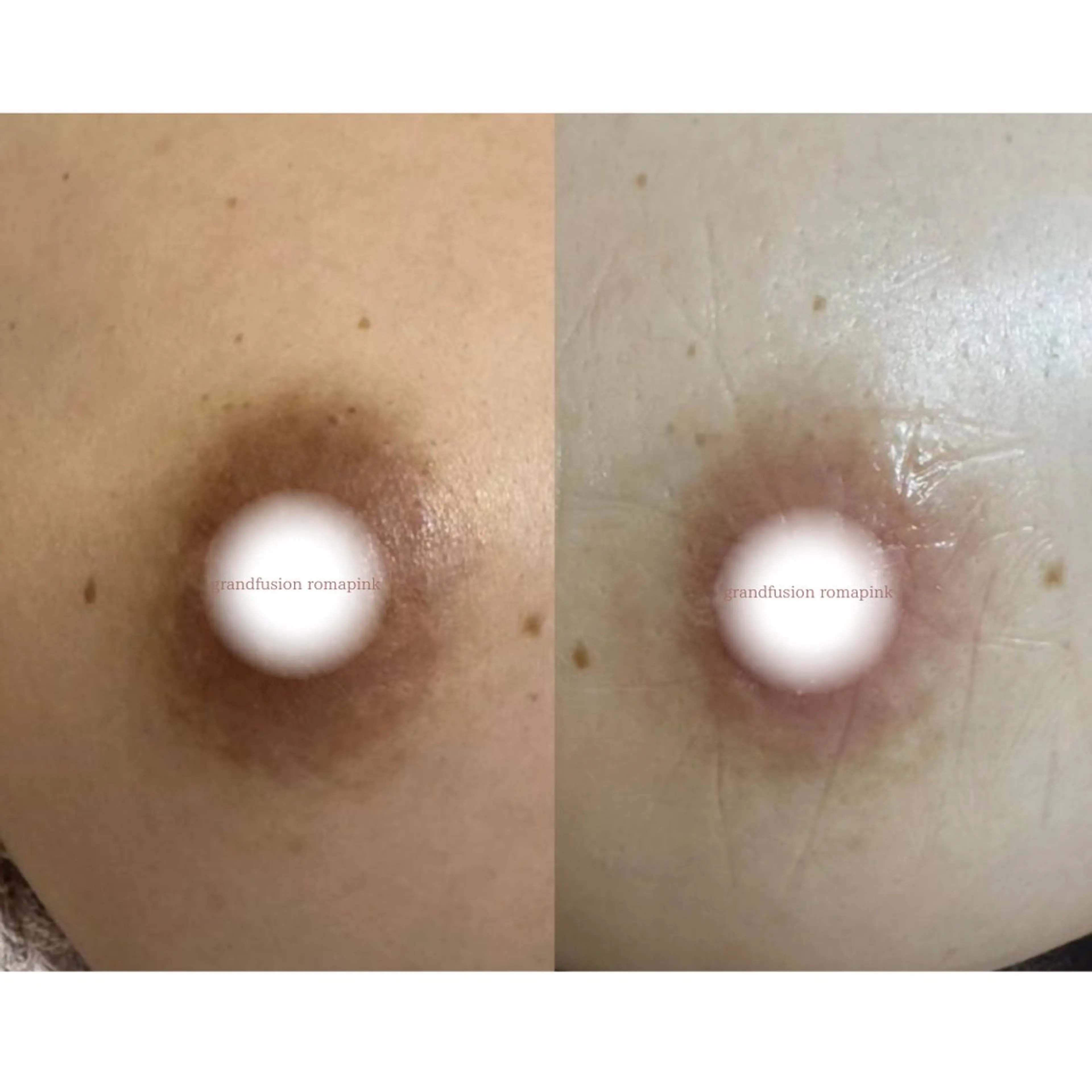 本気で痩せたい方へ 痩身専門サロンのエステ・リラクイメージ