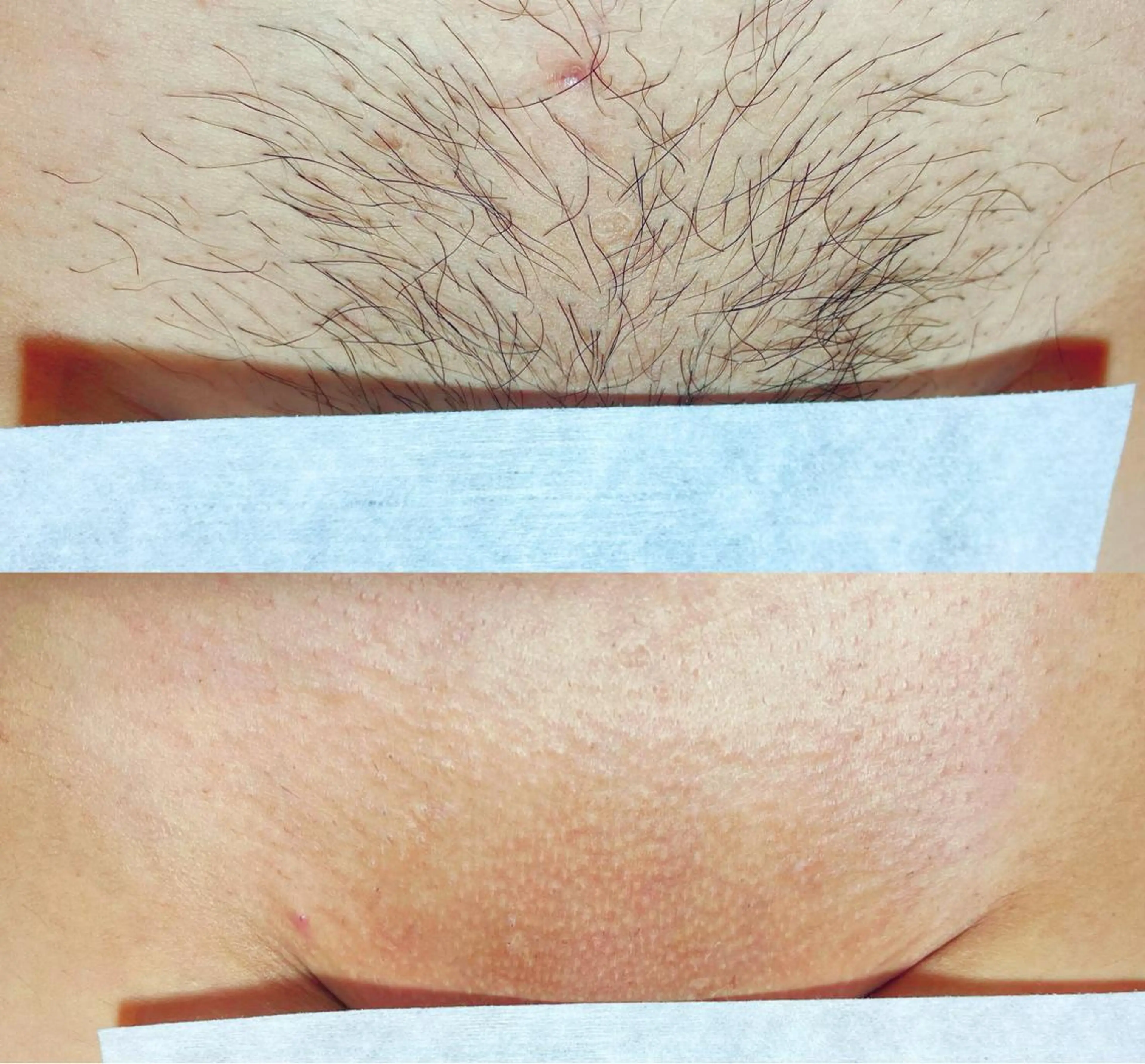 女性限定チクチク、ザラザラとおさらば🌬️ツルスベVIO🍯オールオフの写真