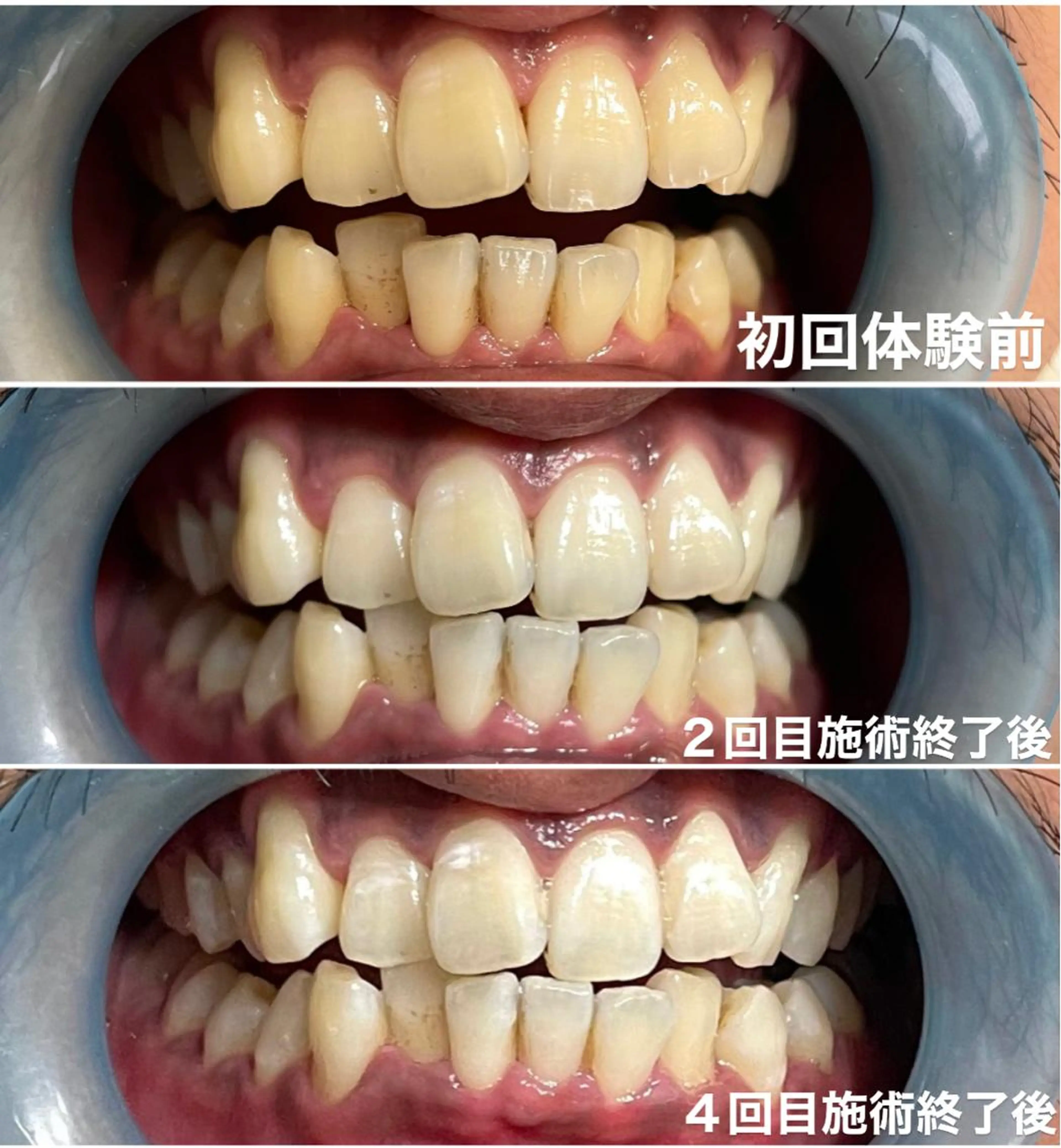 その他 ホワイトニング専門店 Hi-Whiteのその他イメージ