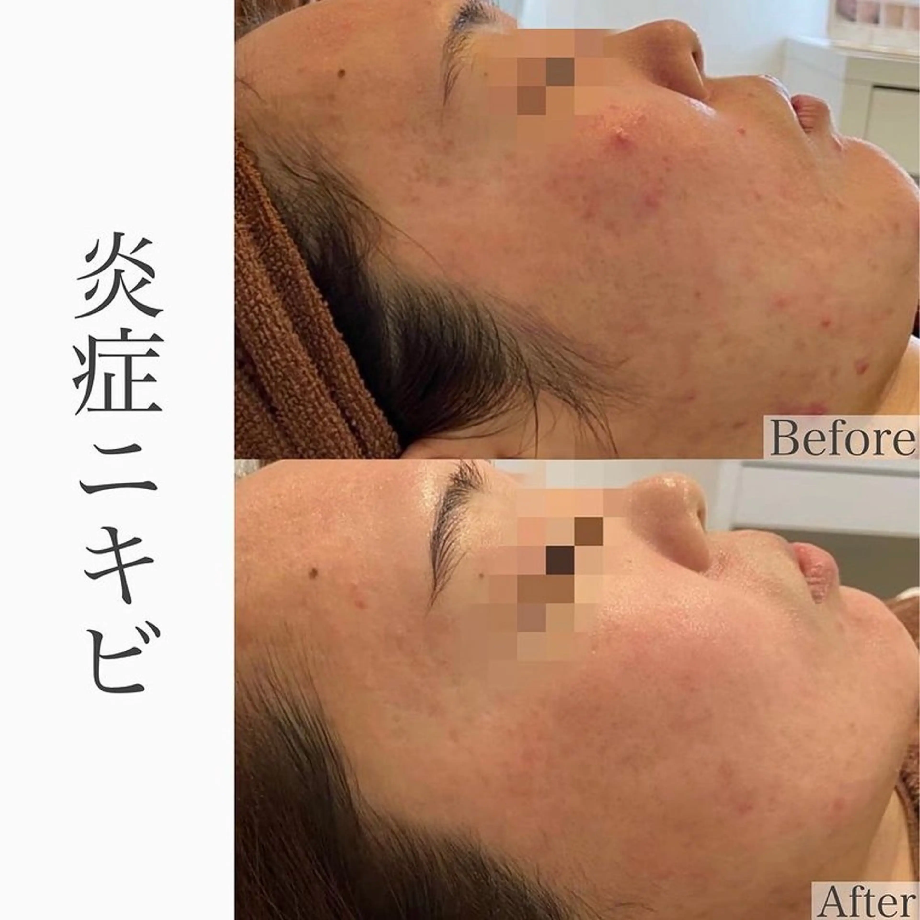 ハーブピーリング専門 BIOEL横浜のエステ・リラクイメージ