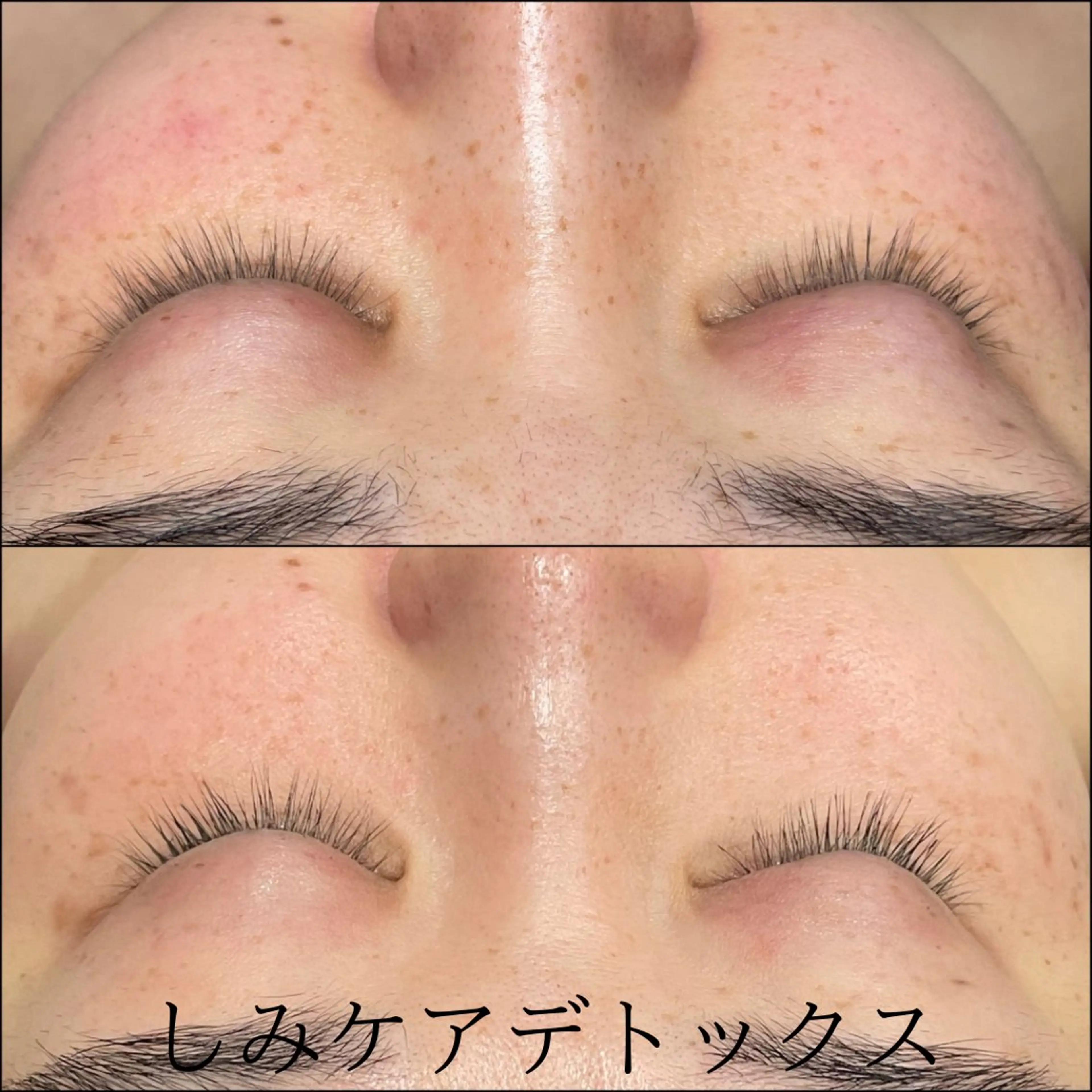 エステ LiZA エステティックサロンのエステ・リラクイメージ