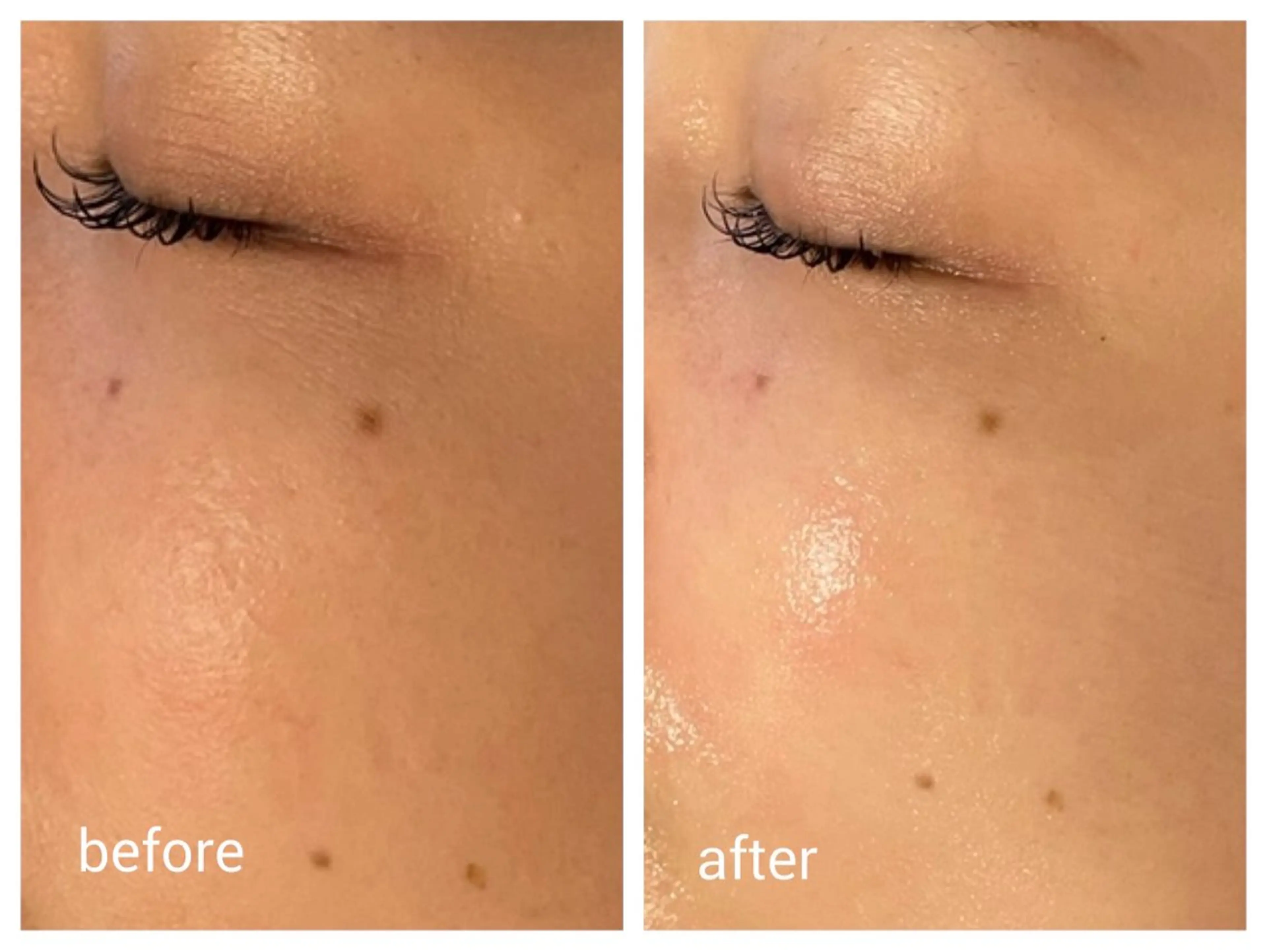 今西 彩夢のエステ・リラクイメージ