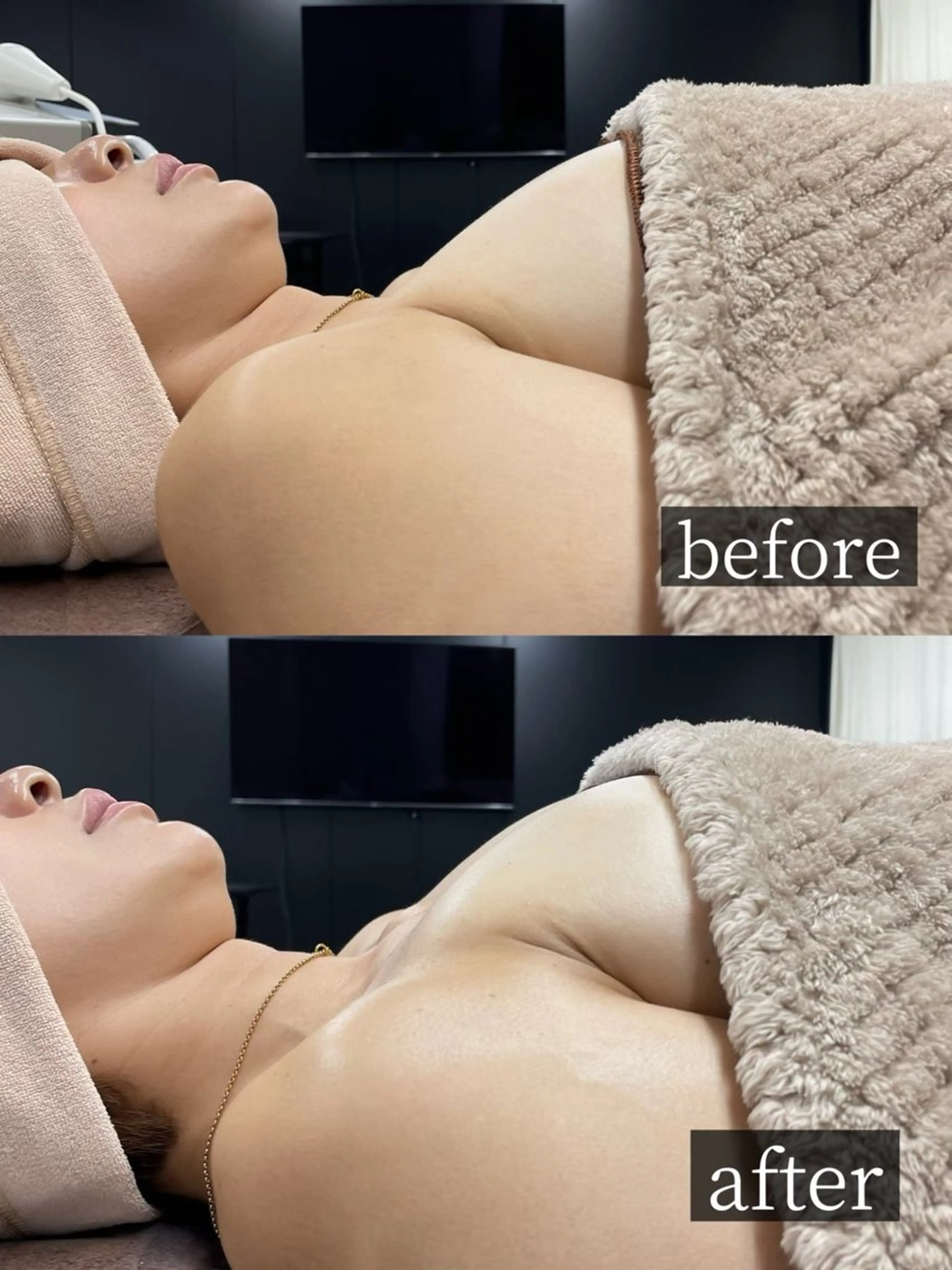 バストアップに特化 した最新機器使用！のエステ・リラクイメージ