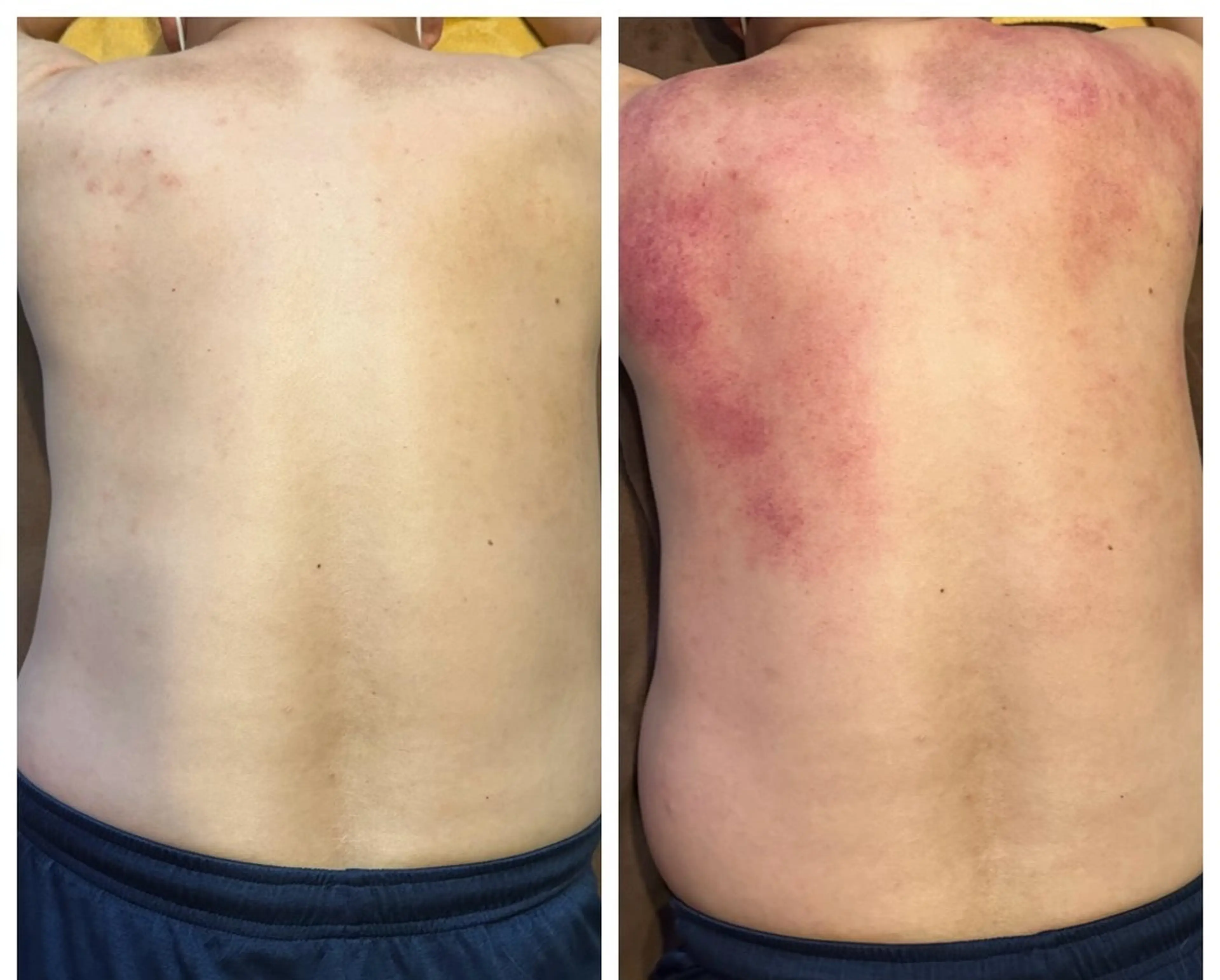 その他 鍼灸院楽々館所属・宇田 碧のエステ・リラクイメージ