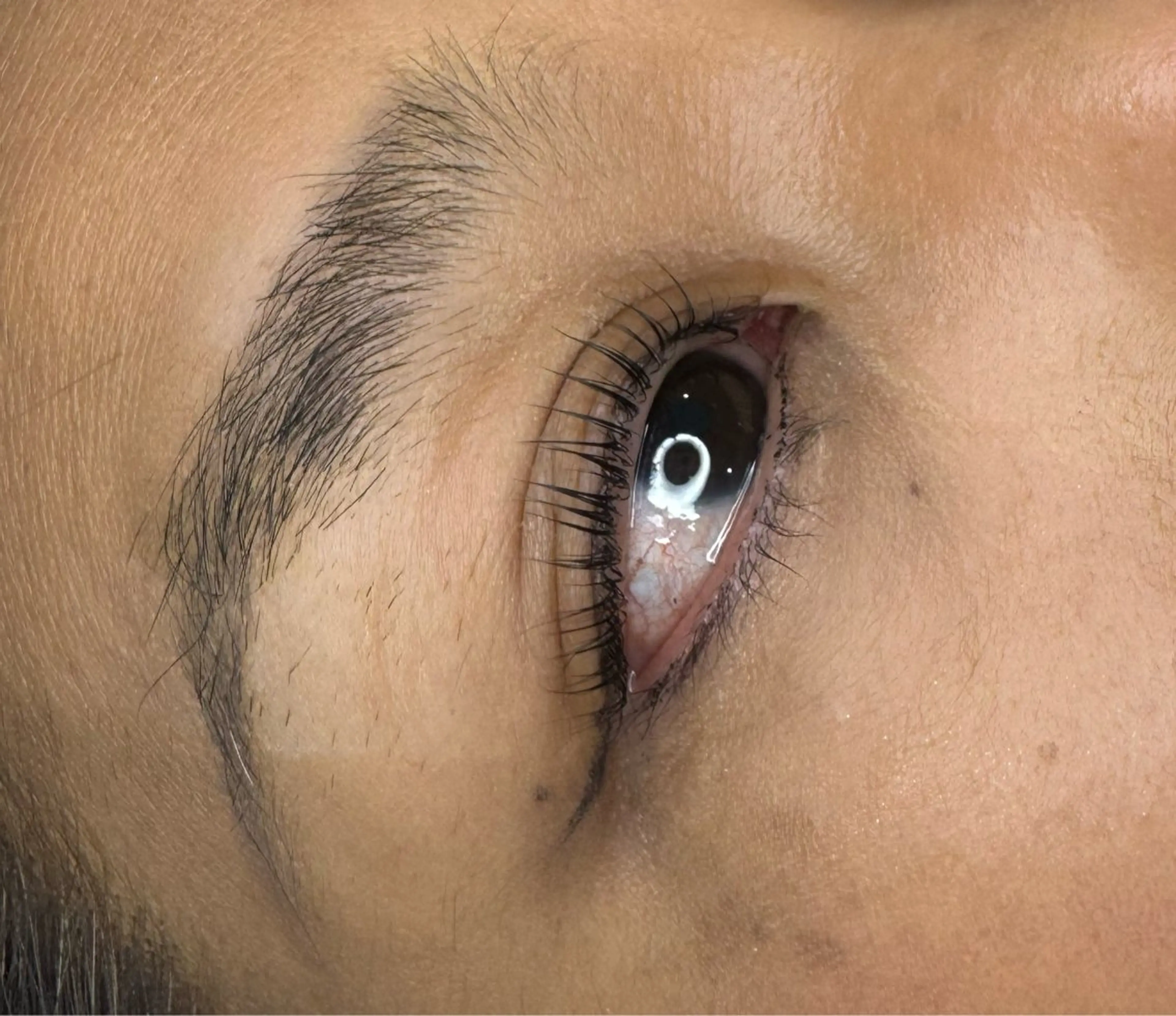 マツエク・マツパ Amaranth所属・Lupinus 小顔矯正のエステ・リラクイメージ