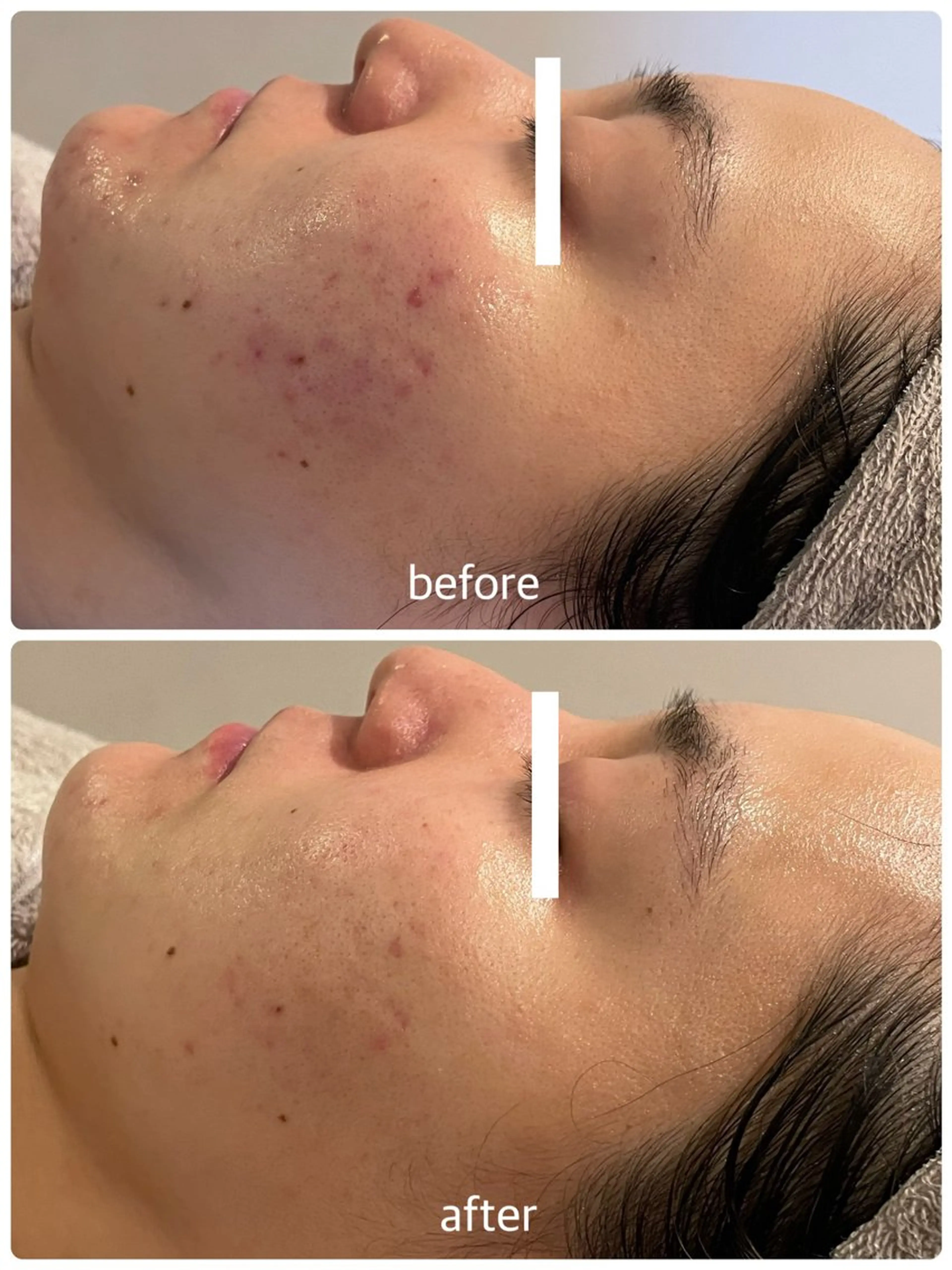 エステティックジュビラン アンビエンテ福井南店所属・坂下 智恵のエステ・リラクイメージ