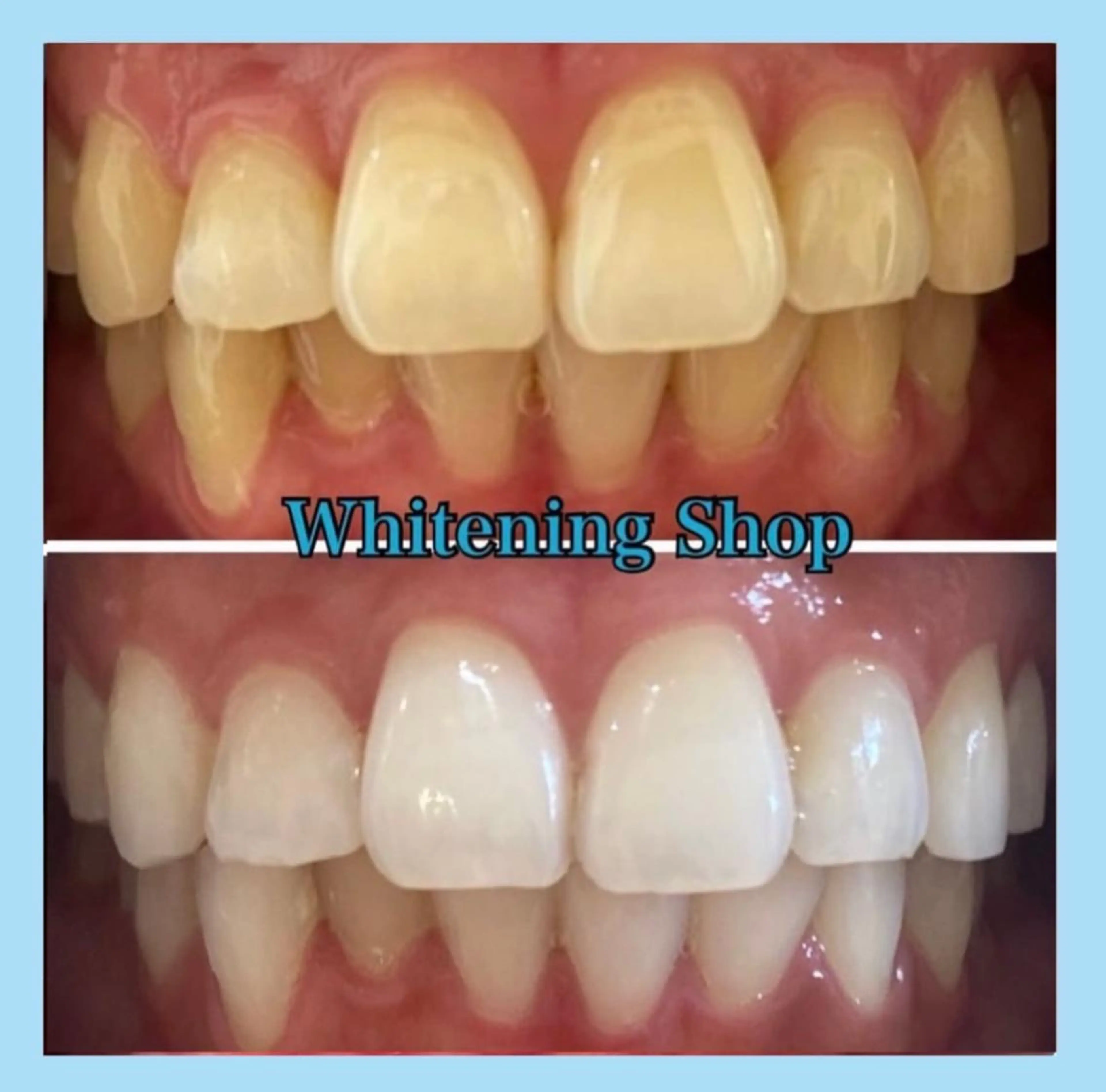 ホワイトニング ショップ千葉店のその他イメージ