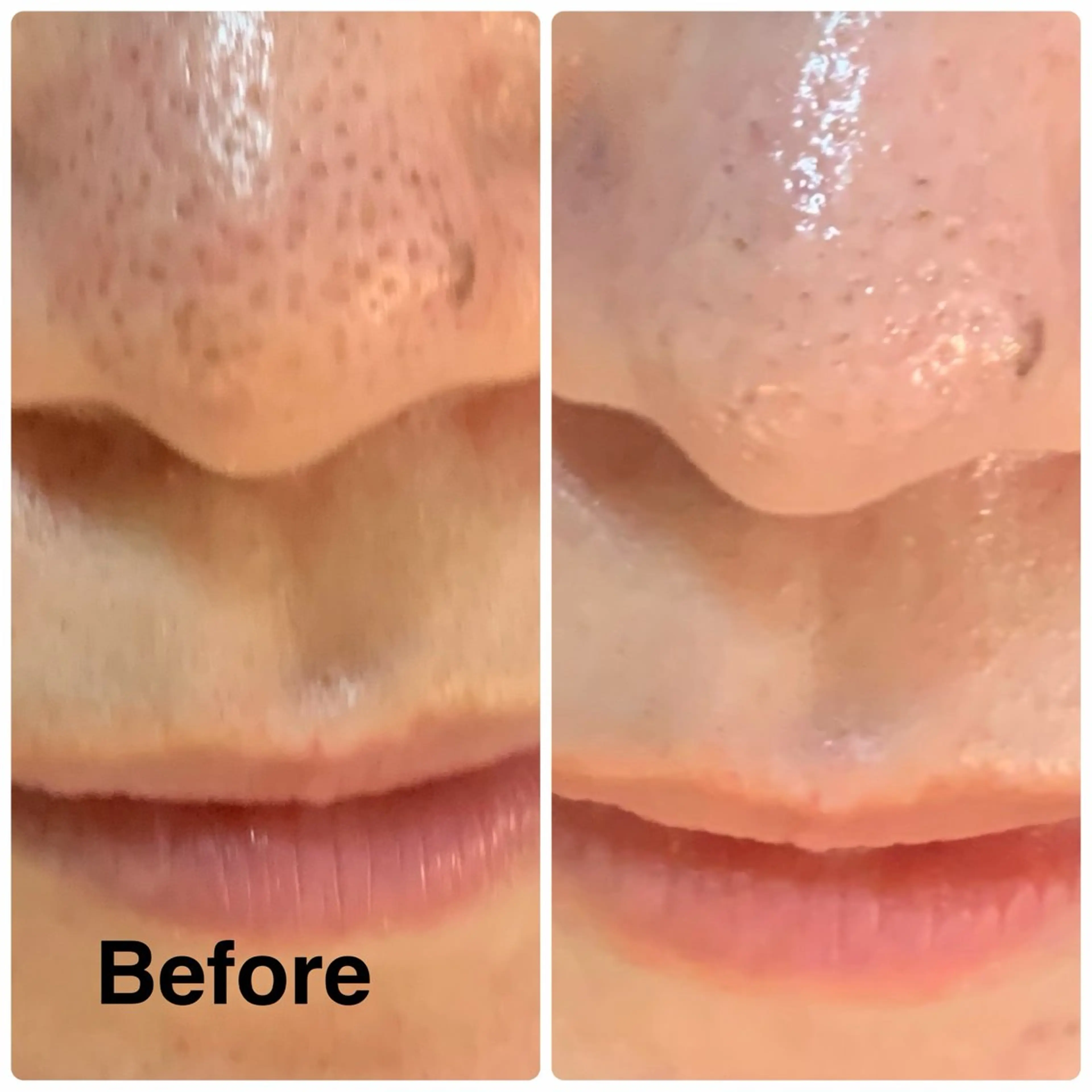 エステ NICORI所属・NICORI大宮 (看護師)塩野飛のエステ・リラクイメージ