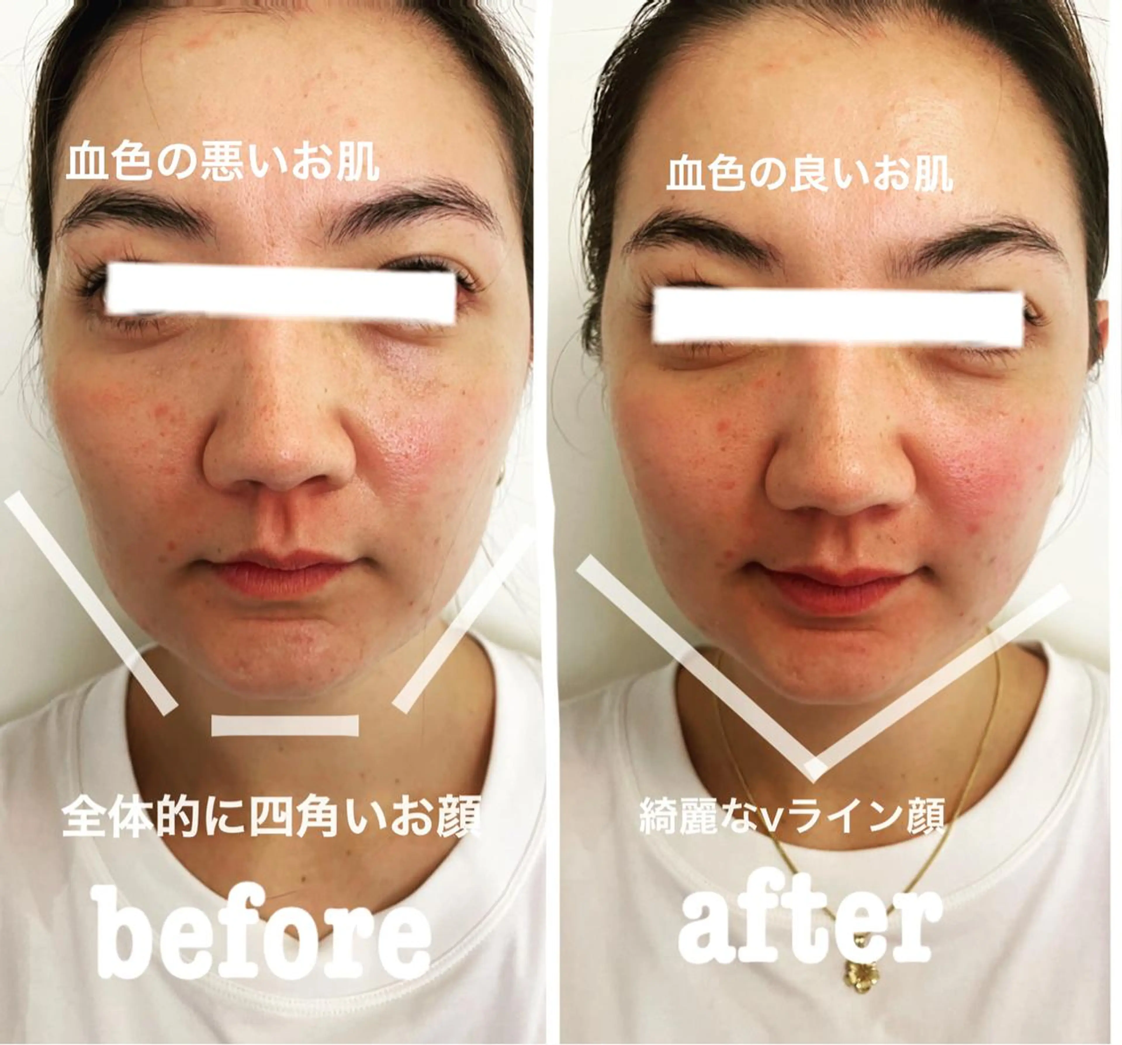 美容鍼灸サロン mahoroba院長のエステ・リラクイメージ